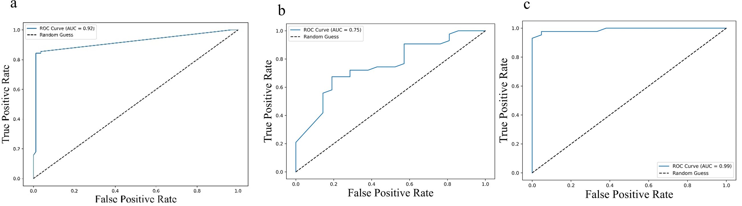 Three ROC curve graphs comparing true positive rate versus false positive rate. The first graph shows an AUC of 0.92, the second 0.75, and the third 0.99. Each graph includes a dashed line representing a random guess.