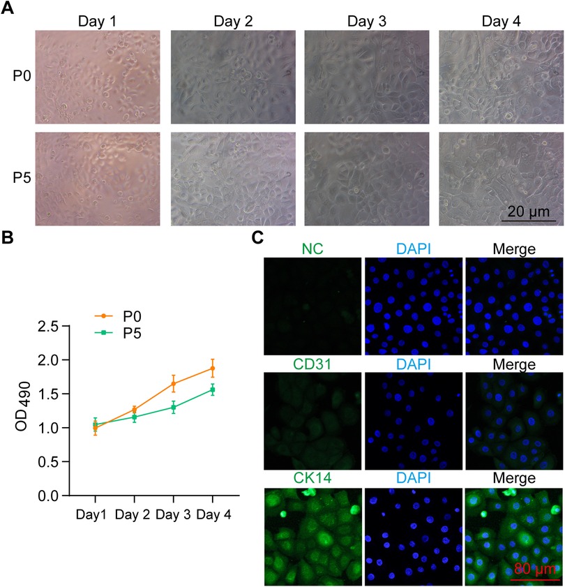 Composite figure showing morphological, proliferative, and immunofluorescent characterization of cells at passage 0 (P0) and passage 5 (P5).Panel A: Phase-contrast microscopy images comparing cell morphology from day 1 to day 4 for P0 and P5. Both groups show increasing confluency over time, with similar morphology. Scale bar is 20 micrometers.Panel B: Line graph of cell proliferation based on OD490 measurements over four days. P0 cells exhibit higher absorbance values than P5, indicating greater proliferation.Panel C: Immunofluorescence images with DAPI nuclear stain and markers NC (negative control), CD31 (endothelial marker), and CK14 (epithelial marker). CK14 shows strong cytoplasmic staining, confirming epithelial identity. Scale bar is 80 micrometers.