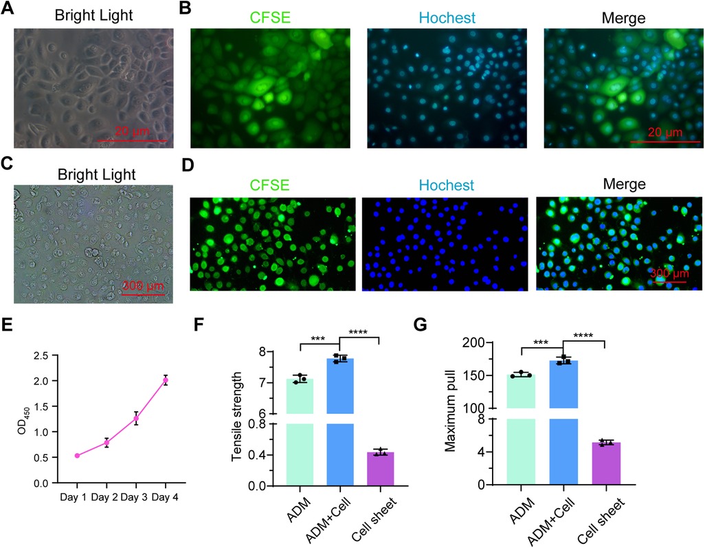 Composite figure assessing cell morphology, proliferation, fluorescence labeling, and mechanical properties of constructs.Panels A–D: Microscopy images showing bright field (A, C) and fluorescence (B, D) of CFSE-labeled cells stained with Hoechst. Panels A and B show higher magnification (scale bar 20 µm); panels C and D show lower magnification (scale bar 300 µm).Panel E: Line graph of cell proliferation measured by OD₄₅₀ over four days, showing a steady increase in absorbance.Panel F: Bar graph comparing tensile strength among ADM, ADM+Cell, and Cell sheet groups. ADM+Cell has the highest strength, followed by ADM and Cell sheet. Significant differences are marked by asterisks.Panel G: Bar graph showing maximum pull force with the same group trend as in panel F, indicating enhanced mechanical performance in the ADM+Cell group.