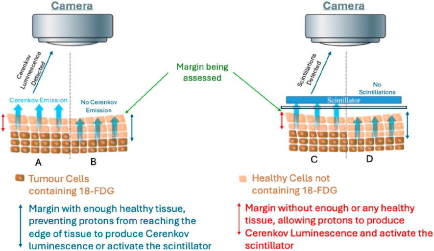 Diagram comparing tumor cells and healthy cells with and without 18-FDG under a camera. Left side shows tumor cells with Cerenkov emission detected at margin