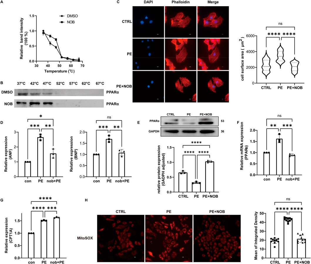A multi-panel scientific figure illustrating various experimental results: Panel A shows a line graph comparing relative band intensity against temperature for DMSO and NOB. Panel B presents Western blot results for PPARα at various temperatures. Panel C includes fluorescent microscopy images with DAPI and phalloidin staining, along with a violin plot of cell surface area for CTRL, PE, and PE+NOB samples. Panel D features bar graphs for relative expression of ANF and BNP. Panel E shows a Western blot and bar graph for PPARα protein expression. Panel F consists of a bar graph of relative mRNA expression of PPARα. Panel G provides a bar graph for CPT1A relative expression. Panel H contains MitoSOX stained images and a bar graph for mean integrated density. Statistical significance is denoted with asterisks.