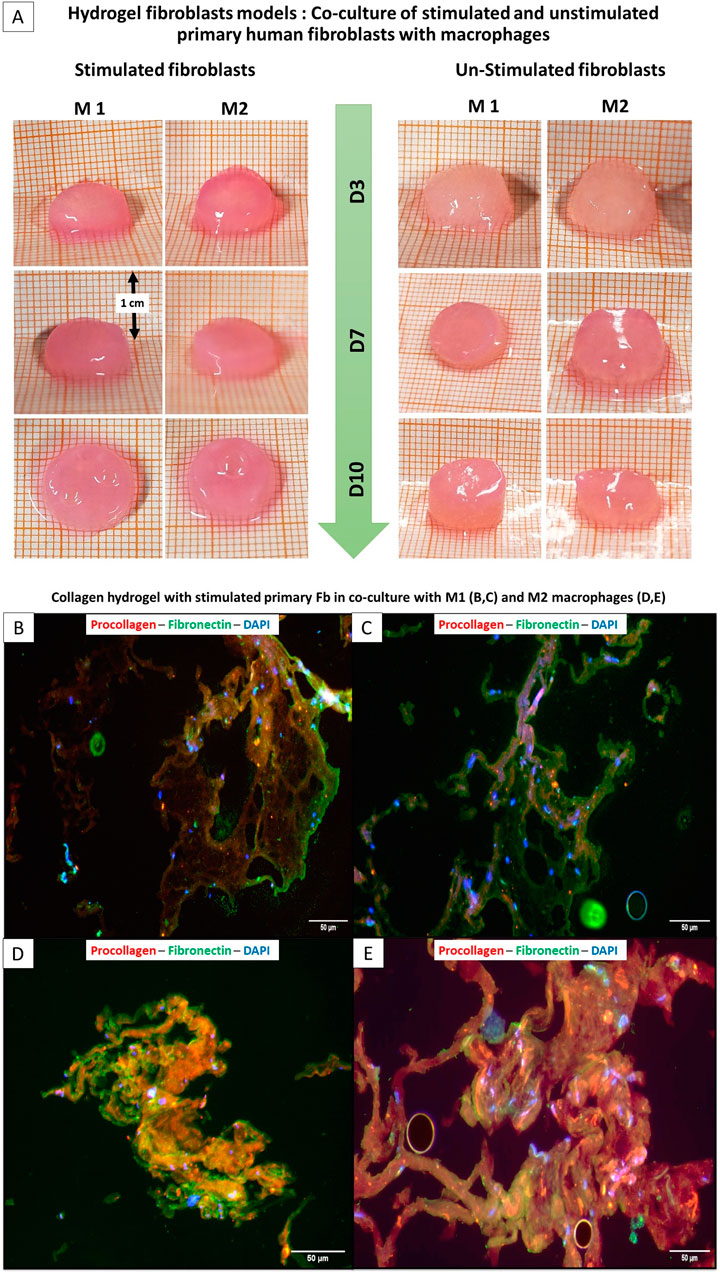 Hydrogel fibroblast models show stimulated and unstimulated primary human fibroblasts co-cultured with macrophages. The top section compares stimulated and unstimulated fibroblasts over three days. The bottom section (labeled B to E) features microscopy images showing procollagen, fibronectin, and DAPI staining. Procollagen is marked in red, fibronectin in green, and nuclei in blue, illustrating different fibroblast interactions and structures.