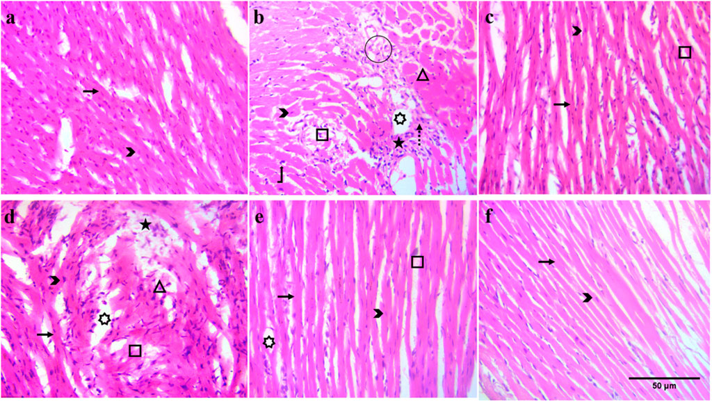 Microscopic images of heart tissue show varying degrees of fibrosis and structural changes. Panels a, b, and d display significant fibrotic changes with marked collagen deposition, indicated by arrows and symbols. Panels c, e, and f exhibit more organized muscle fiber patterns with less fibrosis. Each panel is labeled with different symbols to denote specific histological features. The scale bar represents 50 micrometers.