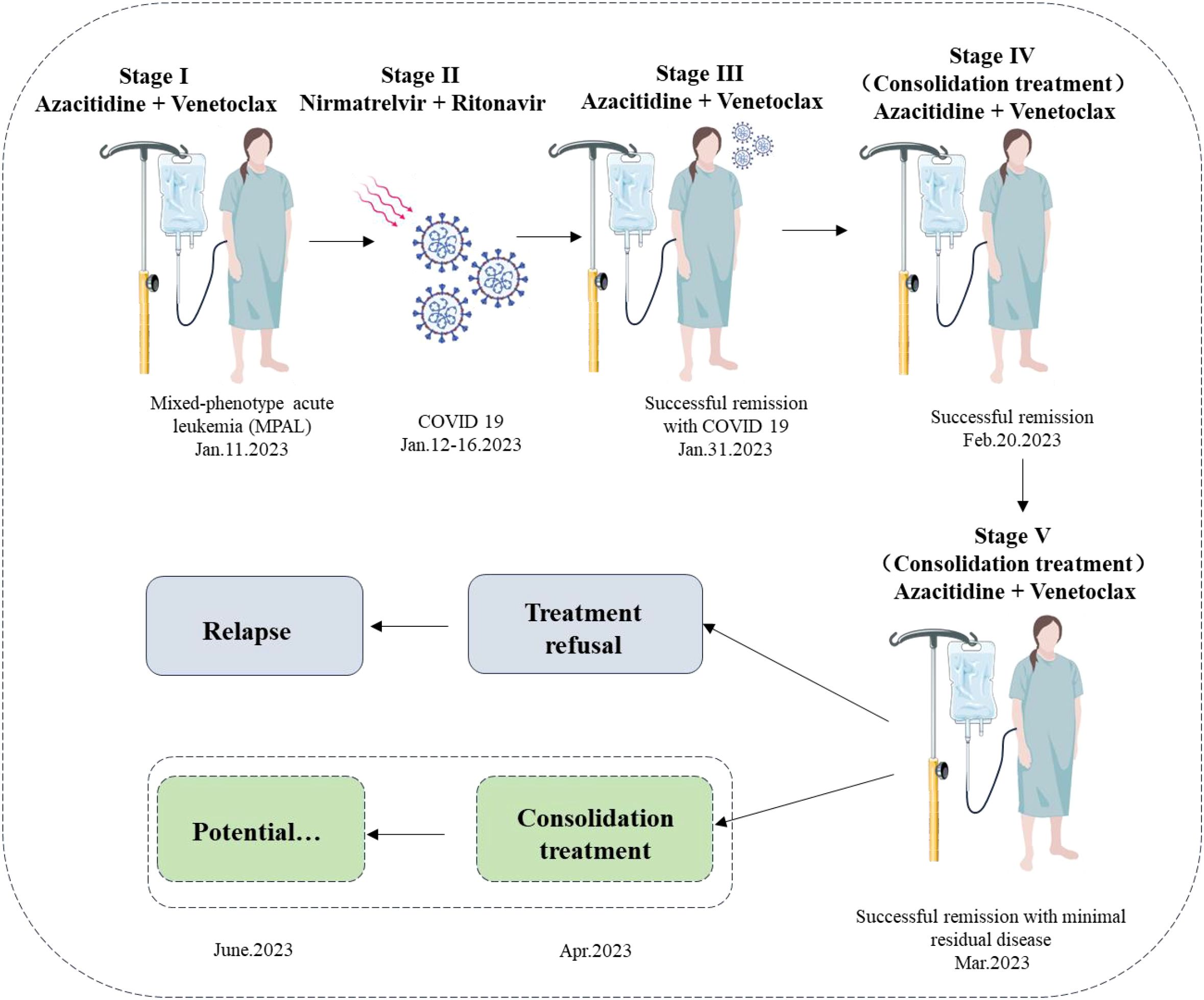 Flowchart illustrating a treatment timeline for mixed-phenotype acute leukemia (MPAL) during COVID-19. Stage I: Treatment with Azacitidine and Venetoclax on January 11, 2023. Stage II: COVID-19 diagnosis from January 12 to 16, 2023, treated with Nirmatrelvir and Ritonavir. Stage III: Remission on January 31, 2023, following continued Azacitidine and Venetoclax. Stage IV and V: Consolidation treatment with successful remission on February 20 and minimal residual disease in March 2023. Arrows indicate progression, with options for treatment refusal leading to relapse, and potential consolidation treatment from April to June 2023.