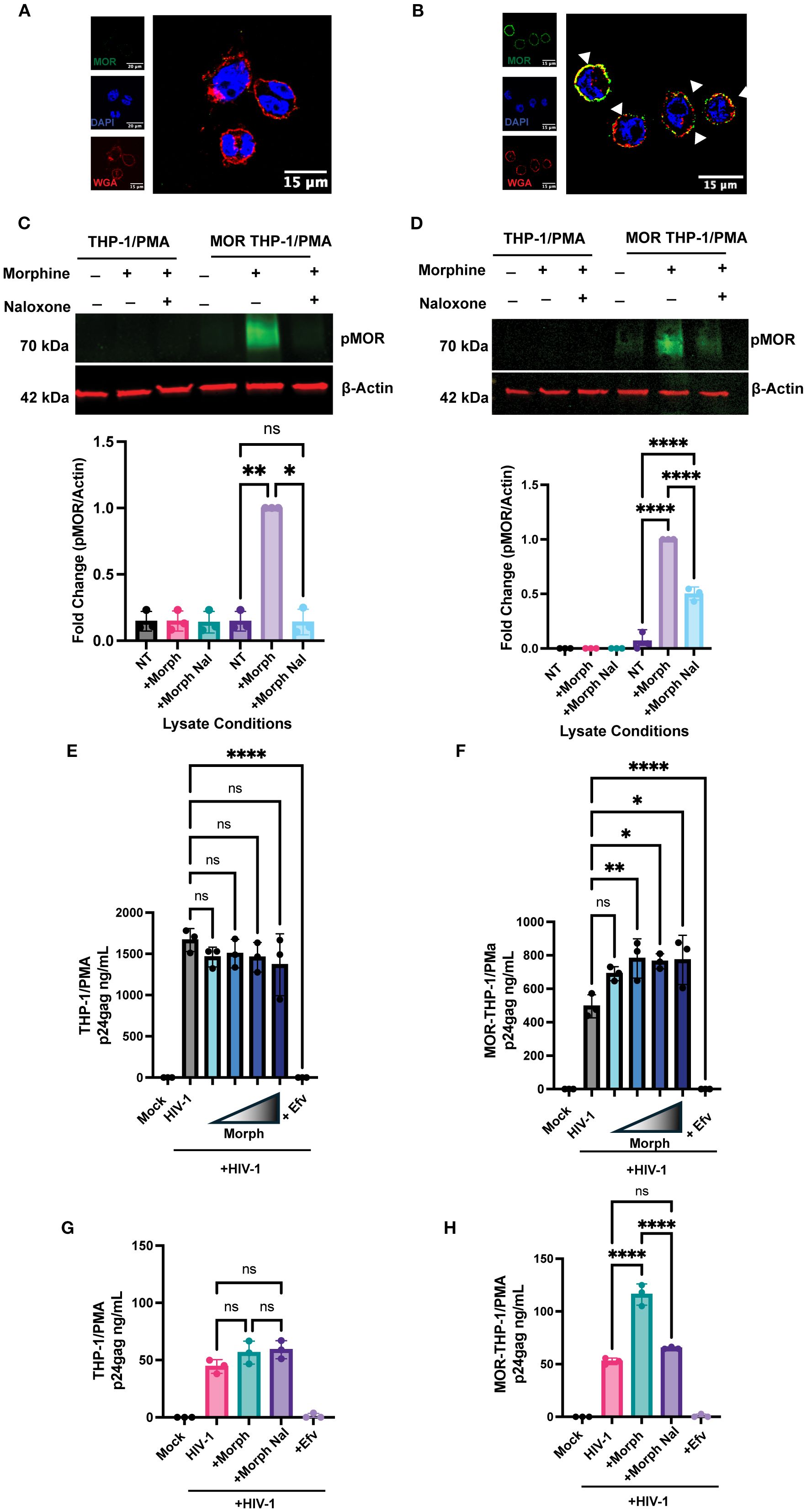 Fluorescence microscopy images and bar graphs showing effects of morphine and naloxone on THP-1/PMA and MOR THP-1/PMA cells. Panels A and B depict cellular staining with markers MOR, DAPI, and WGA. Panels C and D display protein expression levels of pMOR and β-Actin with corresponding bar graphs illustrating fold change comparisons. Panels E to H present bar graphs quantifying p24 antigen levels under various treatment conditions with statistical significance indicated by asterisks. Each figure highlights different responses to morphine, naloxone, and control treatments in a cellular context.