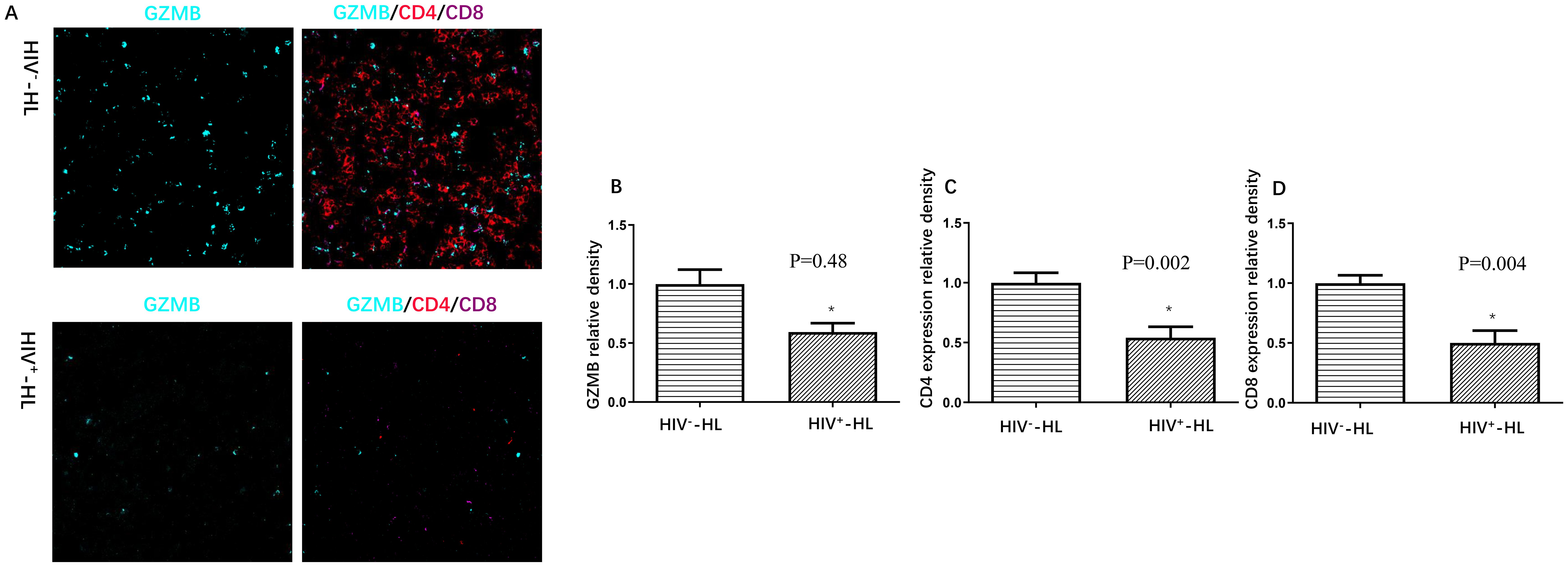 Fluorescence imaging and bar charts compare GZMB, CD4, and CD8 expression in HIV-negative and HIV-positive HL patients. Images show GZMB alone and with CD4/CD8 markers. Bar charts quantify expression, showing reduced levels in HIV-positive patients. Statistical significance is indicated for each marker.