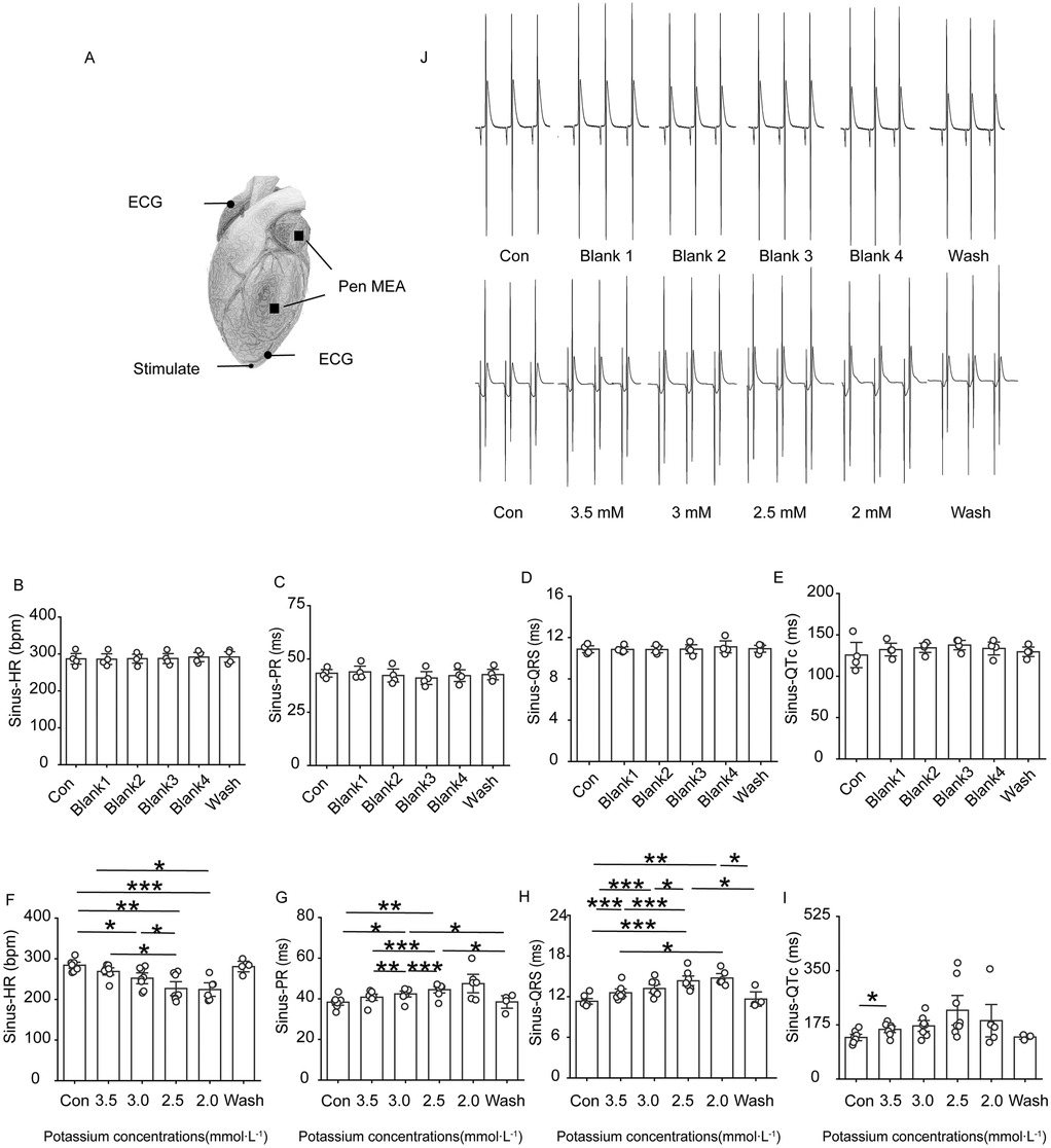 Diagram showing ECG setup on a heart, labeled \