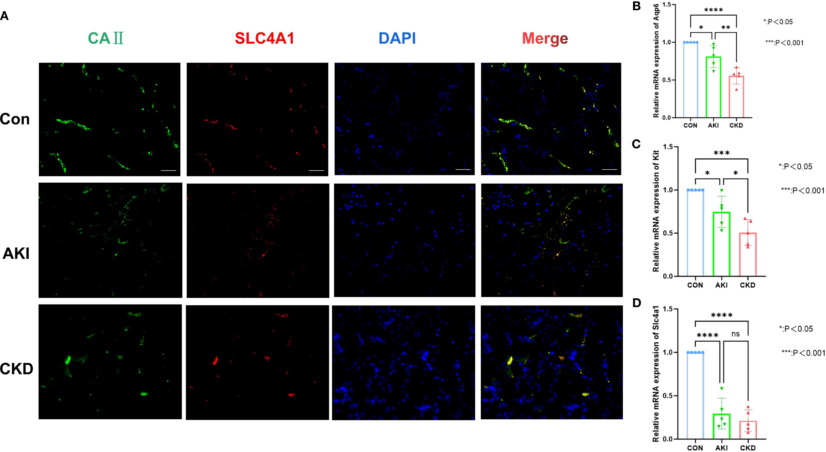 Fluorescent microscopy images and bar graphs comparing control (Con), acute kidney injury (AKI), and chronic kidney disease (CKD) groups. Panel A shows CA II (green), SLC4A1 (red), and DAPI (blue) staining with merged images for each condition. Panels B, C, and D display bar graphs of relative mRNA expression for Aqp6, Kit, and Slc4a1, respectively, with significant differences marked by asterisks indicating p-values.