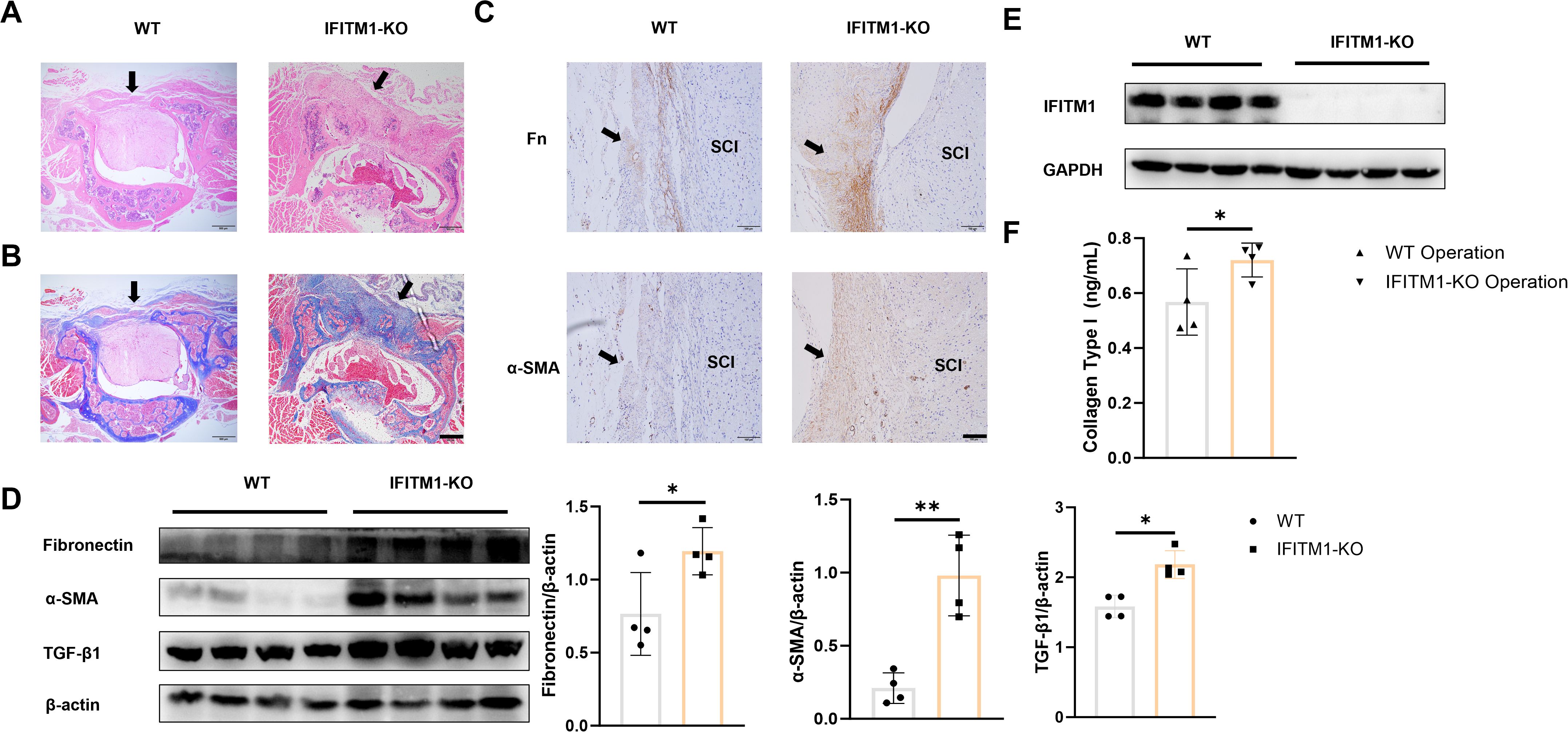Comparison of tissue and protein expression in spinal cord injury (SCI) between wild type (WT) and IFITM1-KO mice. Panels A and B show histological images with arrows indicating injury sites. Panel C presents immunostaining for fibronectin and alpha-SMA with arrows marking staining regions. Panel D depicts Western blot results for fibronectin, alpha-SMA, TGF-beta1, and beta-actin, with corresponding graphs displaying expression levels. Panel E shows Western blots for IFITM1 and GAPDH. Panel F is a bar graph of collagen type I levels, indicating statistical significance marked by asterisks.