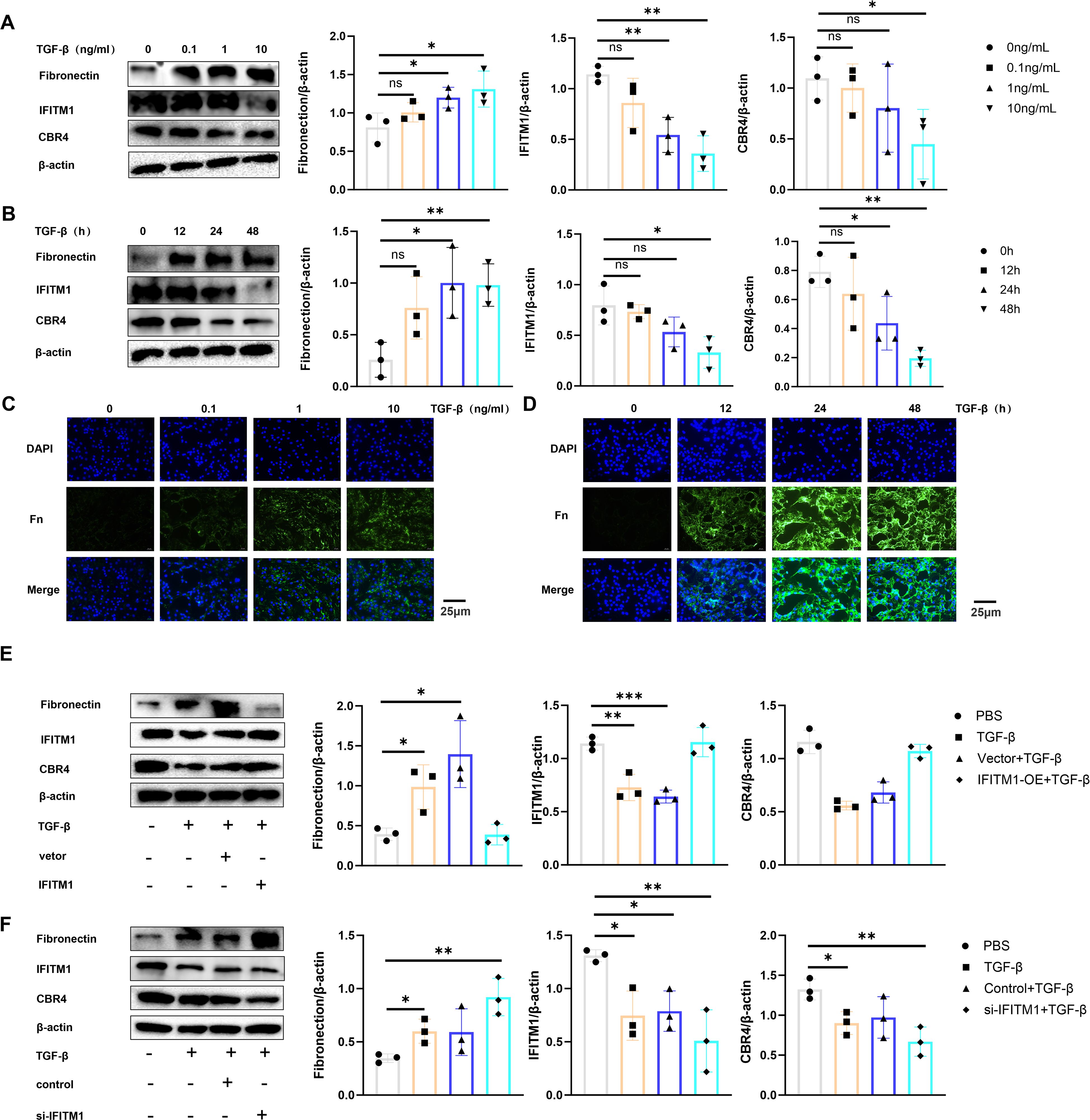 Western blots and fluorescent microscopy images analyze TGF-β effects on fibronectin, IFITM1, and CBR4 expressions. Panels A and B show varying TGF-β concentrations and times impacting protein levels. Panels C and D present fluorescent images of stained cells showing fibronectin distribution. Panels E and F depict Western blots and bar graphs measuring protein expression changes under differing conditions, such as vector, IFITM1-OE, and si-IFITM1 treatments. Statistical significance is indicated with asterisks. Scale bars on microscopy images show 25 micrometers.