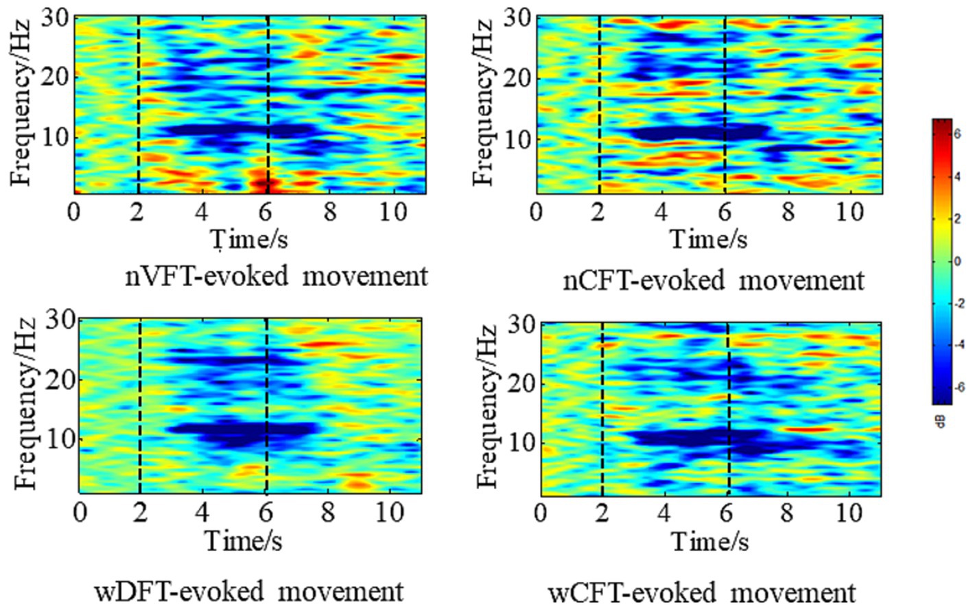 Four spectrograms show frequency over time for different evoked movements: nVFT, nCFT, wDFT, and wCFT. Frequency ranges from zero to thirty Hertz, and time spans zero to ten seconds. Each spectrogram uses a color scale from blue, indicating lower decibels, to red, indicating higher decibels.