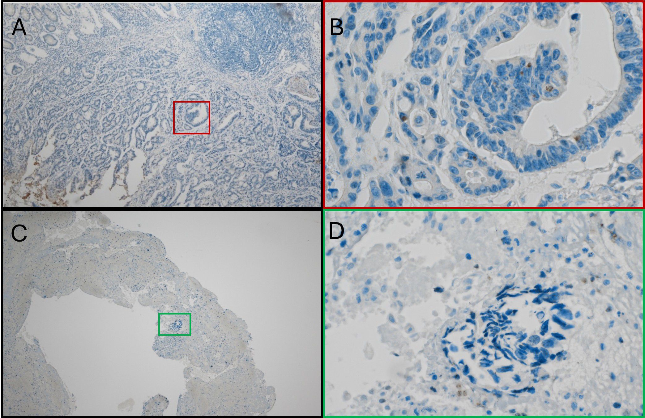 Histological images arranged in a grid with panels labeled A, B, C, and D. Panel A shows a low-magnification view of tissue with a marked section. Panel B is a high-magnification view focusing on cellular structures from A. Panel C shows a different low-magnification tissue section with a marked area. Panel D provides a close-up view of the marked area in C, highlighting cellular details. The stains reveal cellular and structural components in shades of blue and white.