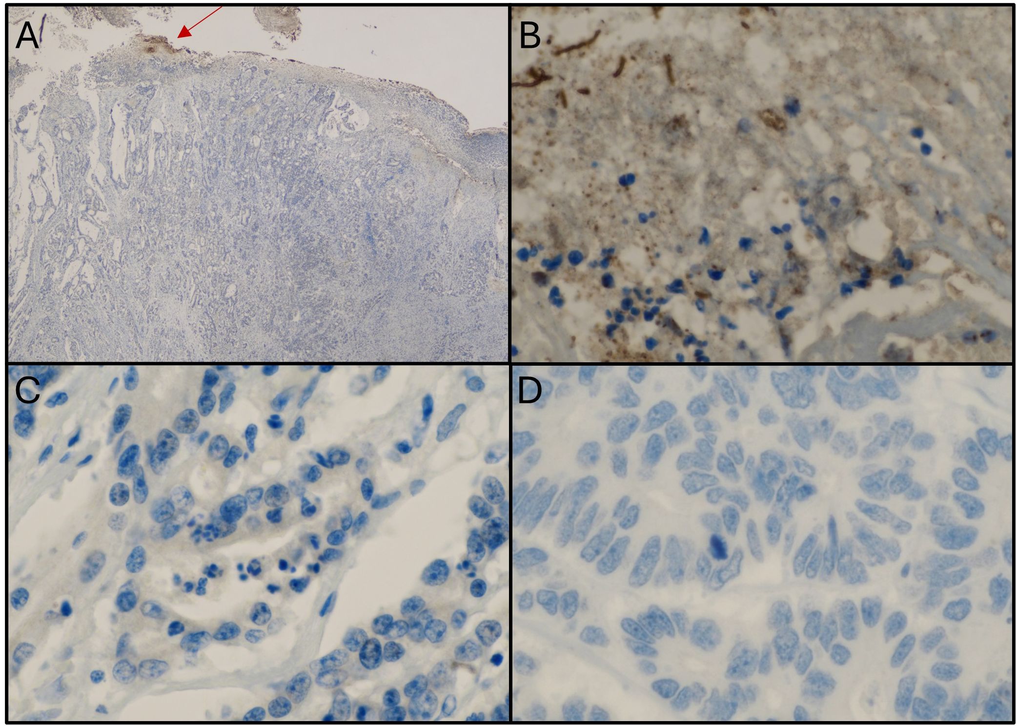 Histological images labeled A through D showing tissue samples stained to highlight cellular structures. Image A shows a broad view with a red arrow indicating a specific area. Image B is a closer view showing darker staining in a more concentrated area with scattered blue-stained nuclei. Image C shows a high magnification of elongated cells with blue staining concentrated in cell nuclei. Image D displays a similar high magnification with predominantly blue nuclei, indicating cell structures.