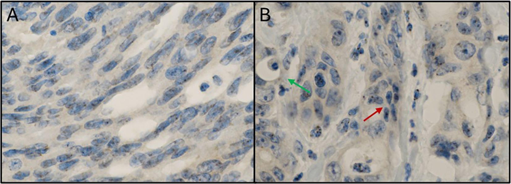 Paired microscopic images labeled A and B. Image A shows oval-shaped, blue-stained nuclei densely packed on a beige background. Image B displays similar blue-stained nuclei with arrows indicating specific features: a green arrow pointing to a structure on the left and a red arrow pointing to another structure on the right.