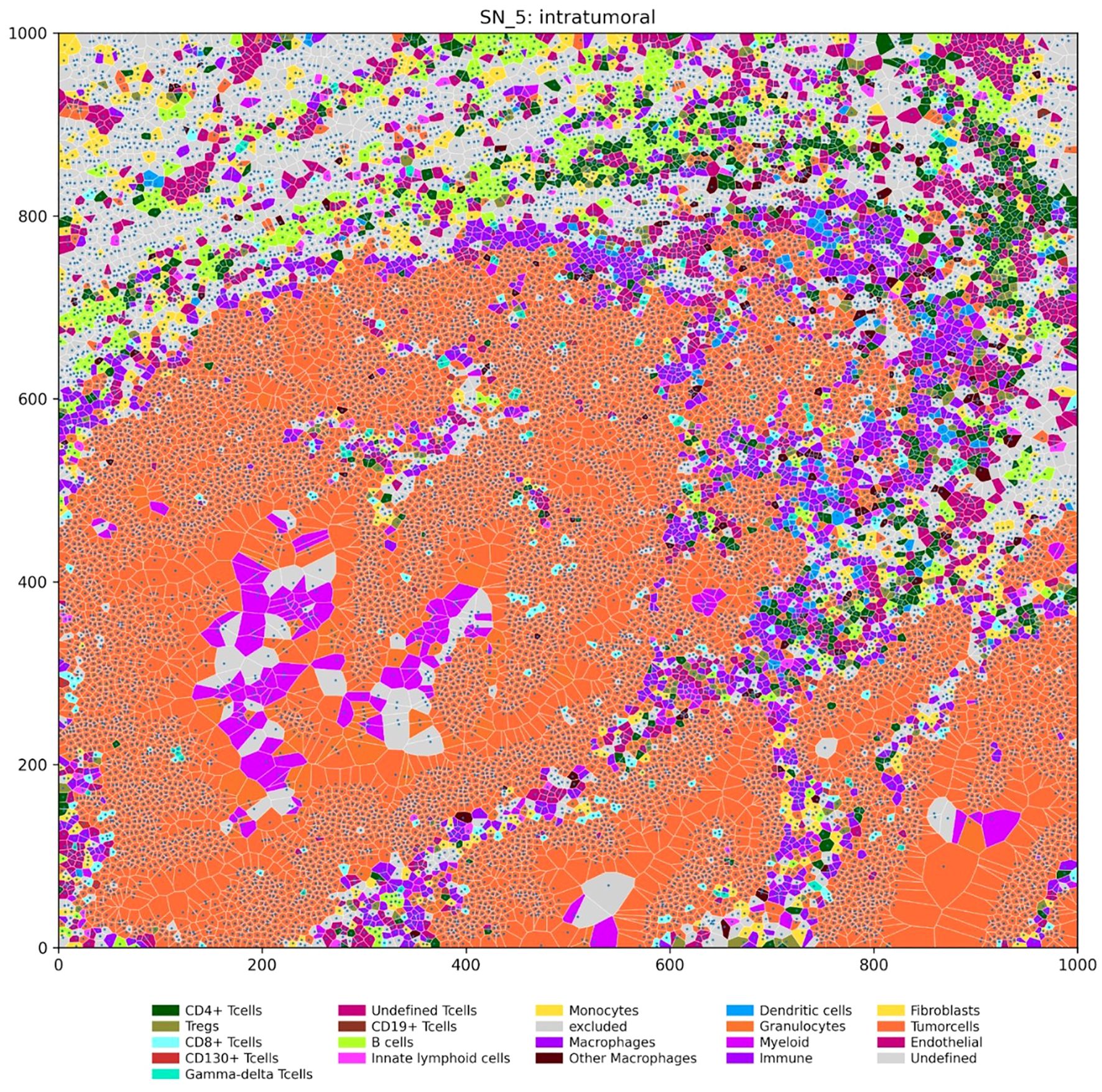 Intratumoral cell map labeled “SN_5,” depicting various cell types using distinct colors. CD4+ T cells, Tregs, B cells, fibroblasts, dendritic cells, granulocytes, and more are represented. The orange area signifies a significant presence of the tumor cells, with a complex distribution of other cell types interspersed. A key at the bottom identifies each cell type by color.