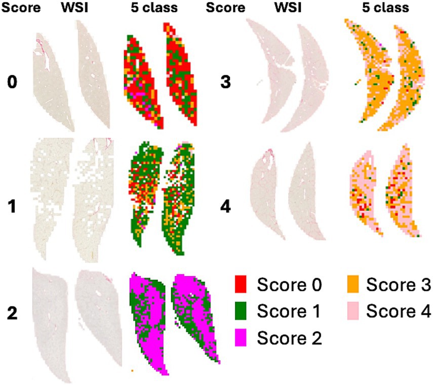 Comparison of whole slide images (WSI) and their classifications into five color-coded scores. Each row corresponds to scores from Score 0 to 4, with WSIs on the left and corresponding classifications on the right. Colors indicate score categories: red for Score 0, green for Score 1, magenta for Score 2, orange for Score 3, and pink for Score 4.