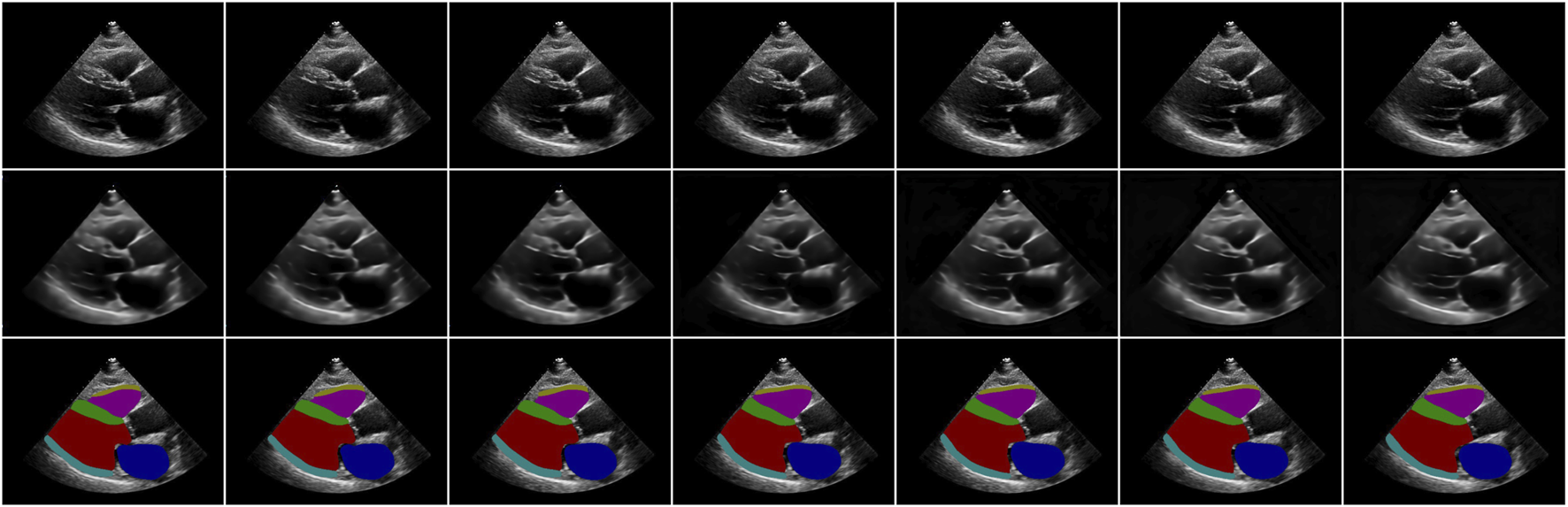 Sequential ultrasound images of a heart, shown in three rows. The first and second row illustrate the original and reconstructed images of a video clip in grayscale. The third row displays the original images with color-coded segmentation highlighting various heart chambers and structures.