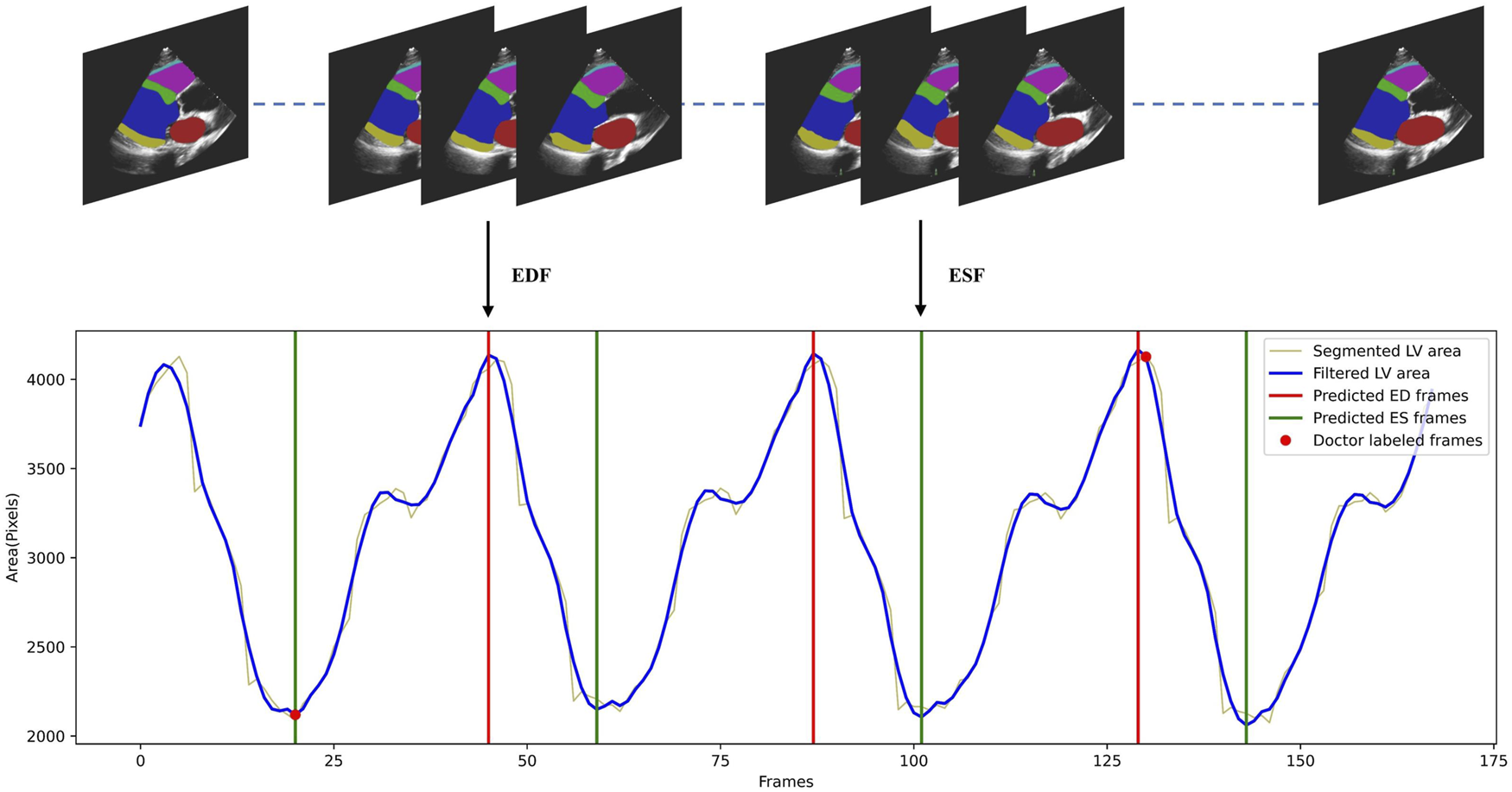 Illustration of the cardiac cycle phase detection process. The top of the figure displays a series of ultrasound images with color-coded segmentation masks. Below, a line graph illustrates left ventricular (LV) area changes over frames. The blue line represents Savitzky-Golay filtered LV area. Green vertical lines and red vertical lines represent the predicted ED frames and ES frames respectively. Red dots mark doctor-labeled frames. Legend indicates segmented LV area, filtered LV area, predicted frames, and labeled frames.