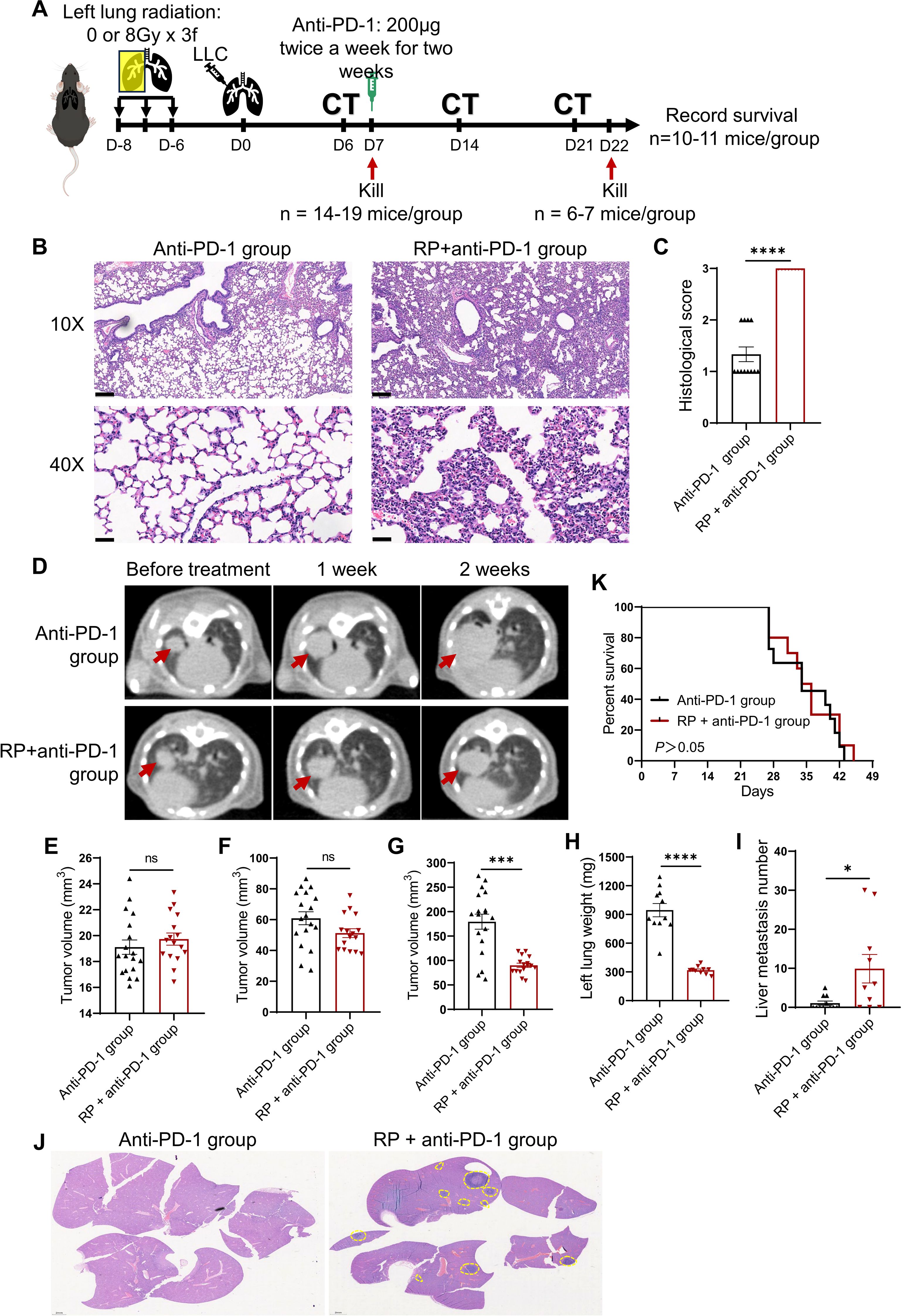 The image shows a scientific study on the effects of anti-PD-1 treatment on lung cancer in mice. Panel A illustrates the experimental timeline, including radiation, treatment, and CT scans. Panel B presents histological images comparing lung tissue in Anti-PD-1 and RP+anti-PD-1 groups. Panel C displays a bar graph of histological scores. Panel D shows CT scans over time. Panels E to I depict graphs comparing tumor volume, lung weight, and metastasis number. Panel J offers additional histopathological images. Panel K is a survival curve comparing the two groups. Significant differences are marked with asterisks.