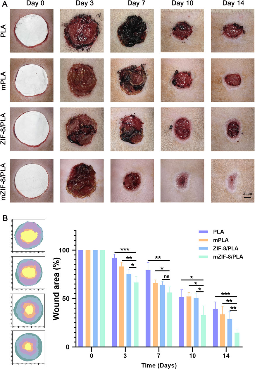 Panel A displays a series of wound healing images over 14 days for different materials: PLA, mPLA, ZIF-8/PLA, and mZIF-8/PLA. Each row shows the progression from Day 0 to Day 14, indicating healing effectiveness and closure over time, with mZIF-8/PLA demonstrating better healing by Day 14. Panel B features a bar graph comparing wound area percentages over time for the materials, with mZIF-8/PLA showing significantly greater healing. Statistical significance is indicated with asterisks.