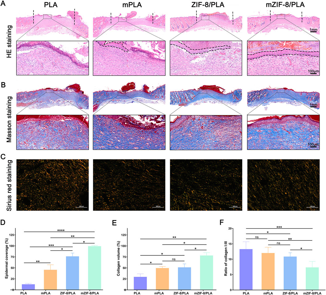 Histological analysis comparing PLA, mPLA, ZIF-8/PLA, and mZIF-8/PLA with panels A, B, and C showing HE staining, Masson staining, and Sirius red staining, respectively. Charts D, E, and F illustrate quantitative comparisons: epidermal coverage, collagen volume, and collagen fiber ratio, respectively, with varying significance levels indicated. Scale bars and labels provide context for measurements.