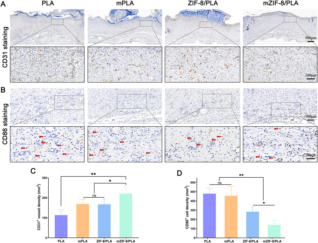 Histological and data analysis of four material types: PLA, mPLA, ZIF-8/PLA, and mZIF-8/PLA. Panel A shows CD31 staining with close-ups indicating vessel differences. Panel B presents CD86 staining with marked areas of interest. Graph C compares CD31+ vessel density, showing significant statistical differences. Graph D compares CD86+ cell density, highlighting notable differences with statistical significance.