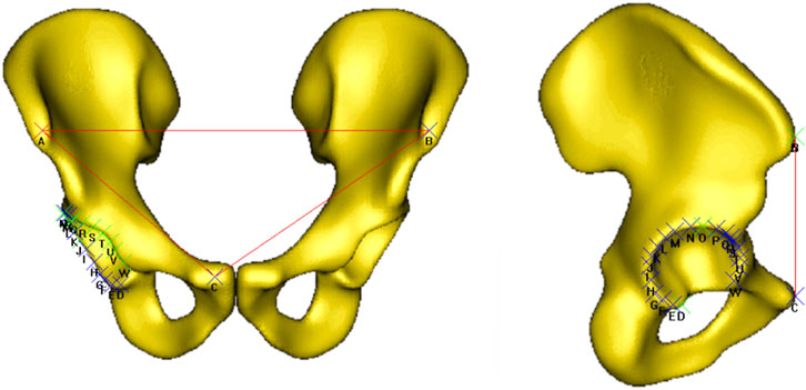 Three-dimensional rendering of hip bones, two are viewed from the front and one from the side. Labeled points A, B, and C are connected by red lines, with additional labels and lines indicating measurement or anatomical reference points. The colors include yellow for the bones and red, blue, and green for lines and labels.