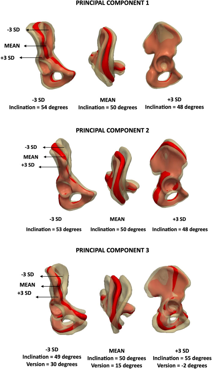 Three panels depict variations in pelvic bone inclination and version angles across three principal components. Each panel shows three pelvic shapes at −3 SD, mean, and +3 SD. The first component shows inclinations at 54,50,48 degrees. The second has 53,50,48 degrees. The third displays inclinations at 49,50,55 degrees and versions at 30,15,−2 degrees.