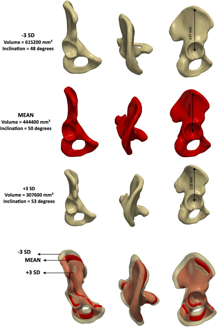 Three-dimensional models of a bone structure are displayed in three groups, representing -3 standard deviations (SD), mean, and +3 SD volumes. The top row, in beige, shows -3 SD with a volume of 615,200 cubic millimeters and a 48-degree inclination. The middle row, in red, shows mean values with a volume of 444,400 cubic millimeters and a 50-degree inclination. The bottom row, in beige, shows +3 SD with a volume of 307,600 cubic millimeters and a 53-degree inclination. The last image combines the three variations, highlighting differences in shape and size.