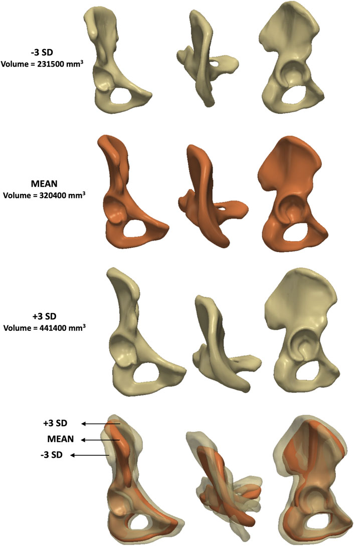 Three rows of 3D pelvic bone models represent variations in volume and shape. The top row shows bones at minus three standard deviations with a volume of two hundred thirty-one thousand five hundred cubic millimeters. The middle row shows the mean with a volume of three hundred twenty thousand four hundred cubic millimeters. The bottom row shows plus three standard deviations with a volume of four hundred forty-one thousand four hundred cubic millimeters. The last row combines all three to highlight differences.