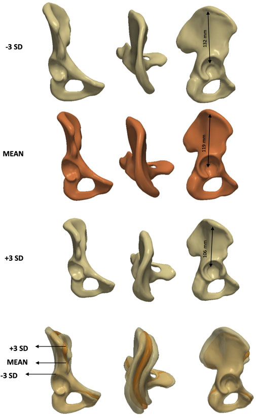 Three sets of 3D-rendered bone structures, labeled as −3 SD, mean, and +3 SD. Each set shows variations in elongation, with measurements indicated as 132 mm, 119 mm and 106 mm.