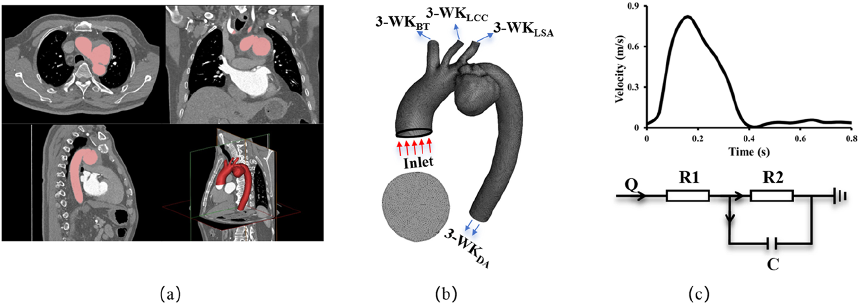 CT scans of aortic anatomy are shown in different views, labeled (a). A 3D model of the aorta with labeled inlets and outlets, labeled (b). A graph and electrical circuit diagram, labeled (c), displaying time versus velocity and circuit components labeled Q, R1, R2, and C, respectively.