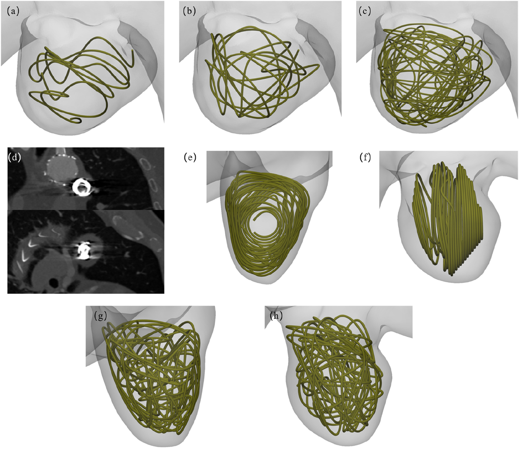 Eight panels showing various representations of anatomical structures with green lines overlaid on grayscale images. Panels (a), (b), (c), (e), (f), (g), and (h) depict 3D models with differently arranged green line patterns. Panel (d) contains two grayscale cross-sectional medical scans with circular and elliptical shapes visible.