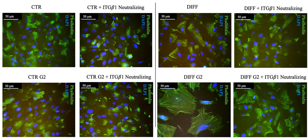 Fluorescent microscopy images showing cells stained with Phalloidin (green) and DAPI (blue). Panels depict various conditions: CTR, CTR + ITGβ1 Neutralizing, DIFF, DIFF + ITGβ1 Neutralizing, CTR G2, CTR G2 + ITGβ1 Neutralizing, DIFF G2, and DIFF G2 + ITGβ1 Neutralizing. Each panel includes a scale bar of 50 micrometers.