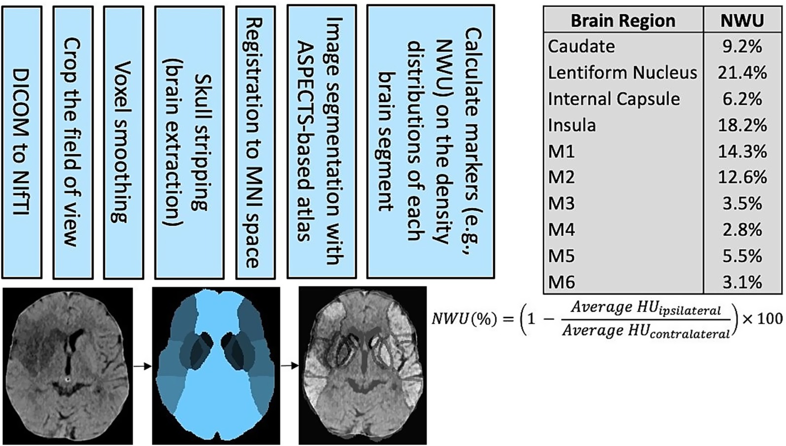 Flowchart detailing image processing steps for brain imaging: converting DICOM to NIfTI, cropping, smoothing, skull stripping, registration to MNI space, and image segmentation. Includes a table showing NWU percentages for brain regions. Below are three images: a brain scan, a segmented brain image, and a labeled scan, with a formula for NWU calculation.