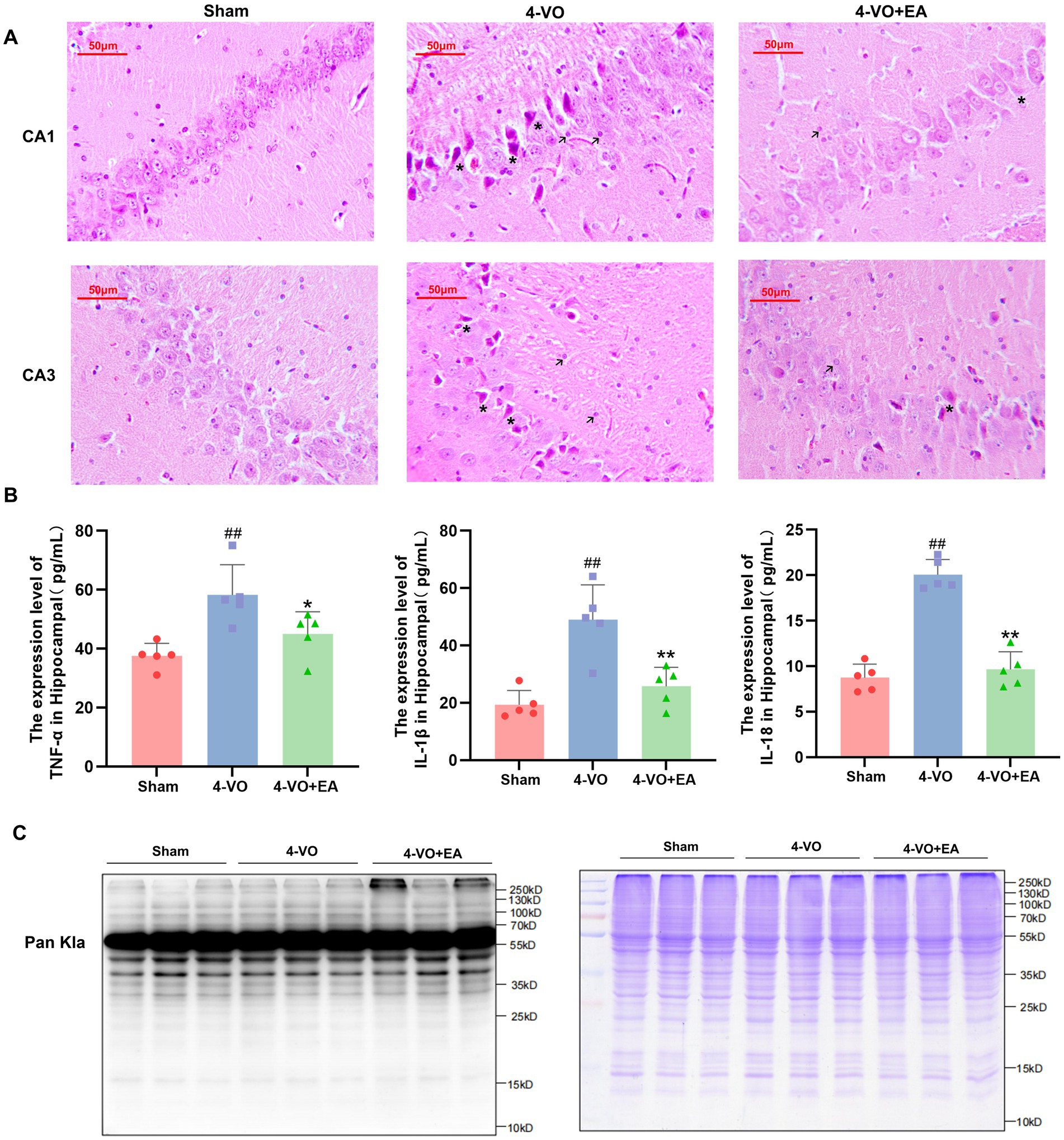 Histological and biochemical analysis of hippocampal tissue. Panel A shows microscopic images of the CA1 and CA3 regions under different conditions: Sham, 4-VO, and 4-VO+EA, with cellular details visible. Panel B presents bar graphs showing expression levels of TNF-alpha, IL-1beta, and IL-18 across conditions, indicating significant differences. Panel C includes western blot images for Pan Kla protein under the same conditions, displaying varying band intensities.