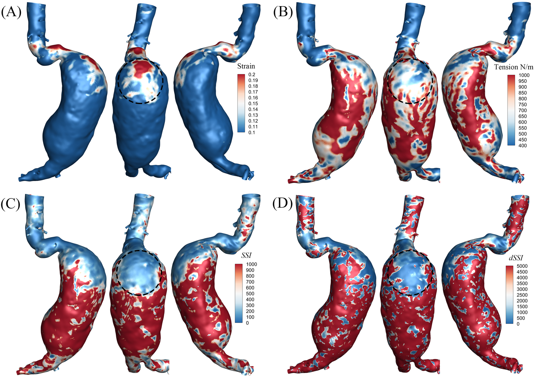 Four 3D visualizations of an anatomical structure are shown, each in three views. (A) Displays strain values, with a color gradient indicating levels from red (high) to blue (low). (B) Represents tension measured in N/m with a gradient from red to blue. (C) Illustrates SSI with a similar color scale. (D) Shows dSSI values, also using a gradient from red to blue. Each visualization highlights variations in stress or tension within the structure.