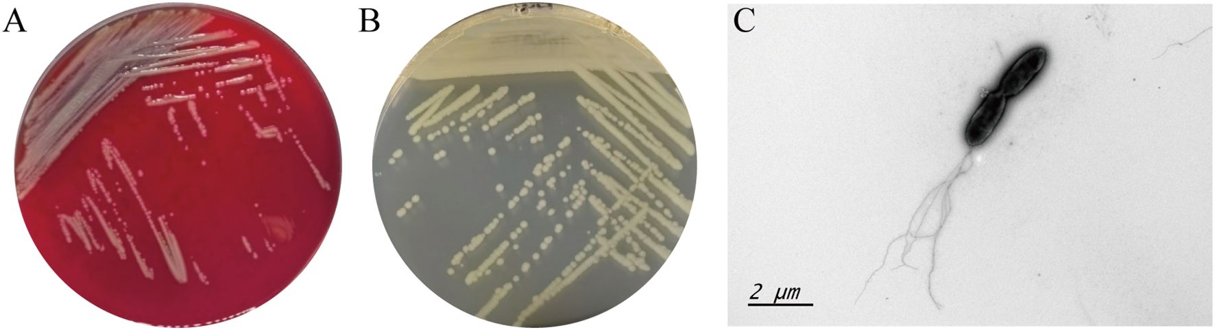 Three panels depicting bacterial growth and structure. Panel A shows grayish white, non-hemolytic colonies of this strain on the blood agar. Panel B displays its colorless, transparent, smooth and moist colonies on the nutrient agar. Panel C is an electron micrograph showing rod-shaped bacteria with 1-5 flagella at the single extreme.
