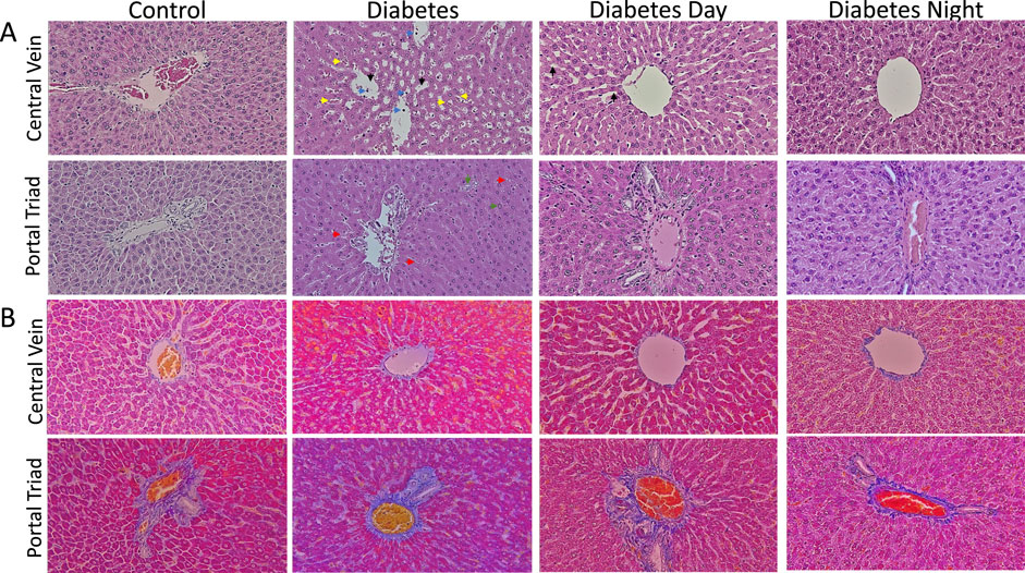 Histological images of liver tissues in two sections (A and B), showing variations in central vein and portal triad structures across different conditions: Control, Diabetes, Diabetes Day, and Diabetes Night. Each condition shows different cellular arrangements and staining intensities, indicating differences in tissue morphology and potential pathological changes.