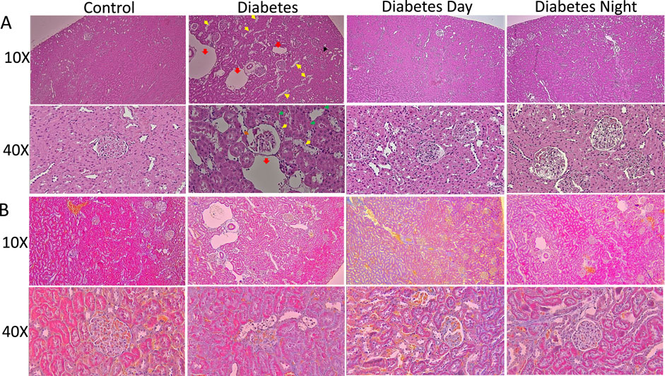 Histological slides comparing kidney tissues. Panel A and B each show Control, Diabetes, Diabetes Day, and Diabetes Night conditions at magnifications of 10X and 40X. The slide indicates differences in tissue structure and staining, which may highlight variations in disease pathology or treatment effects. Arrows in the slides point to specific tissue changes.