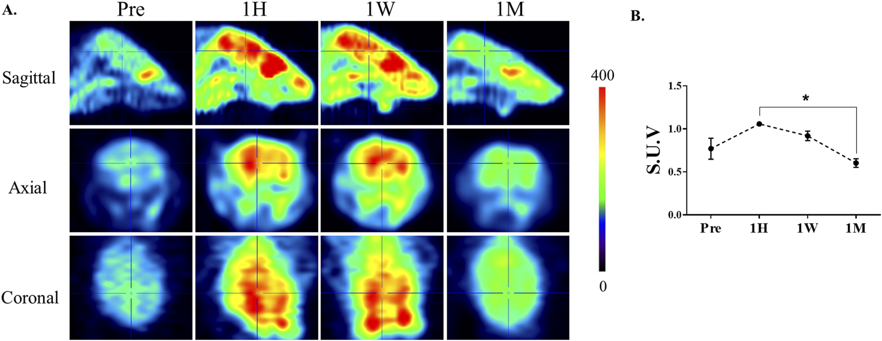 PET scan images in sagittal, axial, and coronal views show brain activity over time: Pre, 1 Hour, 1 Week, and 1 Month. Colors range from blue to red, indicating low to high activity. A graph shows standardized uptake value (SUV) over the same periods, with a peak at 1 Week and a decrease by 1 Month.