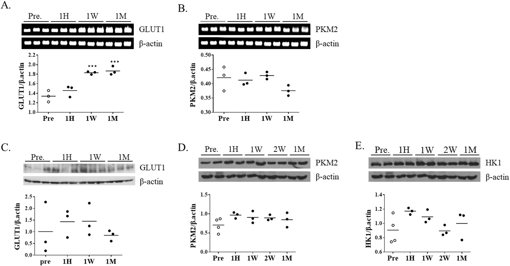 Five panels (A–E). Panels A and B show RT‐PCR bands and bar graphs of GLUT1 and PKM2 mRNA (β–actin control) across time points (Pre, 1H, 1W, 2W, 1M). GLUT1 mRNA is significantly increased at 1 week and 1 month, whereas PKM2 mRNA shows no marked change. Panels C–E show Western blots and quantitative graphs of GLUT1, PKM2, and HK1 proteins normalized to β-actin at the same time points. Individual data points (n = 3) are displayed; significance indicated by * or ** vs Pre.