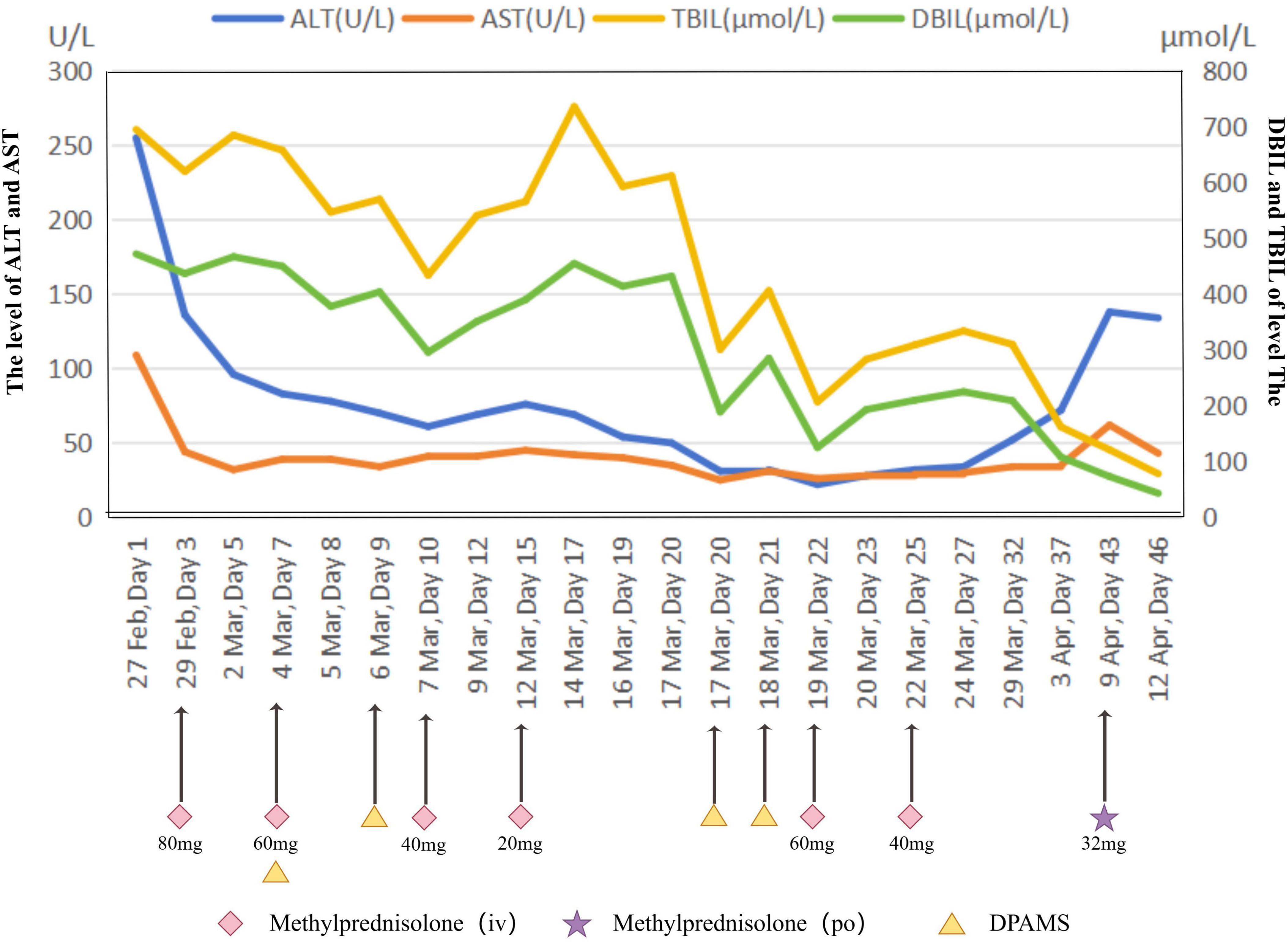 Line graph showing liver enzyme and bilirubin levels over time with annotated treatment points. ALT (blue) and AST (orange) decrease consistently. TBIL (green) and DBIL (yellow) fluctuate but trend downward. Key dates are marked with methylprednisolone treatments in various doses and DPAMS, correlating with changes in levels.