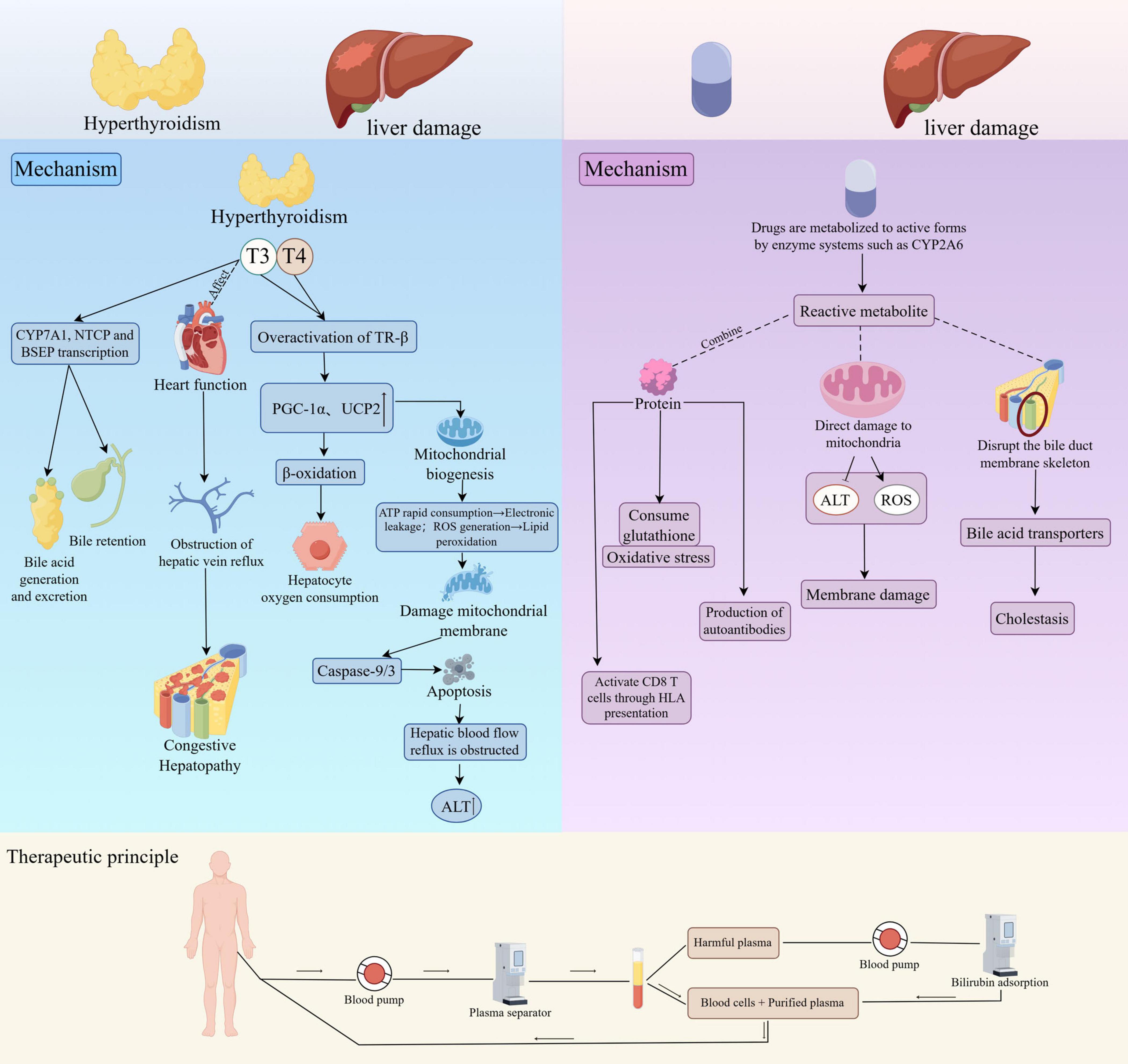 Illustration depicting mechanisms of liver damage caused by hyperthyroidism and drug metabolism. The left panel shows hyperthyroidism leading to liver damage through processes like mitochondrial biogenesis, bile retention, and apoptosis. The right panel explains drug metabolism resulting in liver damage via reactive metabolites causing oxidative stress and cholestasis. Below, a therapeutic principle is illustrated, involving a blood pump and plasma separator to clean blood, absorbing bilirubin and removing harmful plasma.