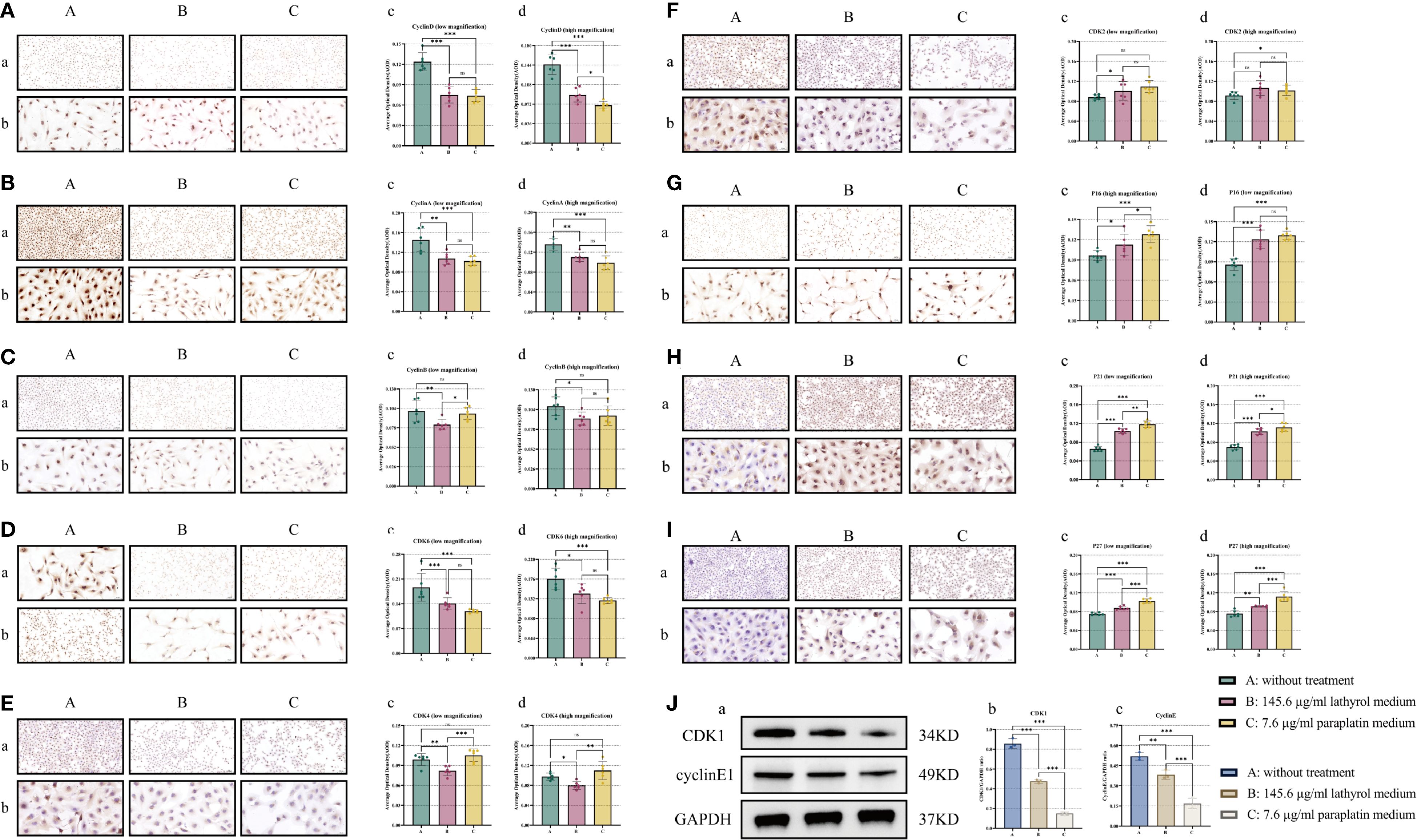 Panels A to I show immunohistochemical staining of cells with various treatments at low (a) and high (b) magnifications. Columns A, B, and C correspond to different concentrations of treatments. Graphs numbered c and d in each panel depict quantitative analysis of staining intensity for discussed proteins, with statistical significance marked. Panel J displays a Western blot with bands for CDK1, cyclin E1, and GAPDH, alongside their respective bar charts illustrating expression levels under different treatments. Treatment groups are defined as A: without treatment, B: 145.6 micrograms per milliliter lathyrol medium, C: 7.6 micrograms per milliliter paraplatin medium.