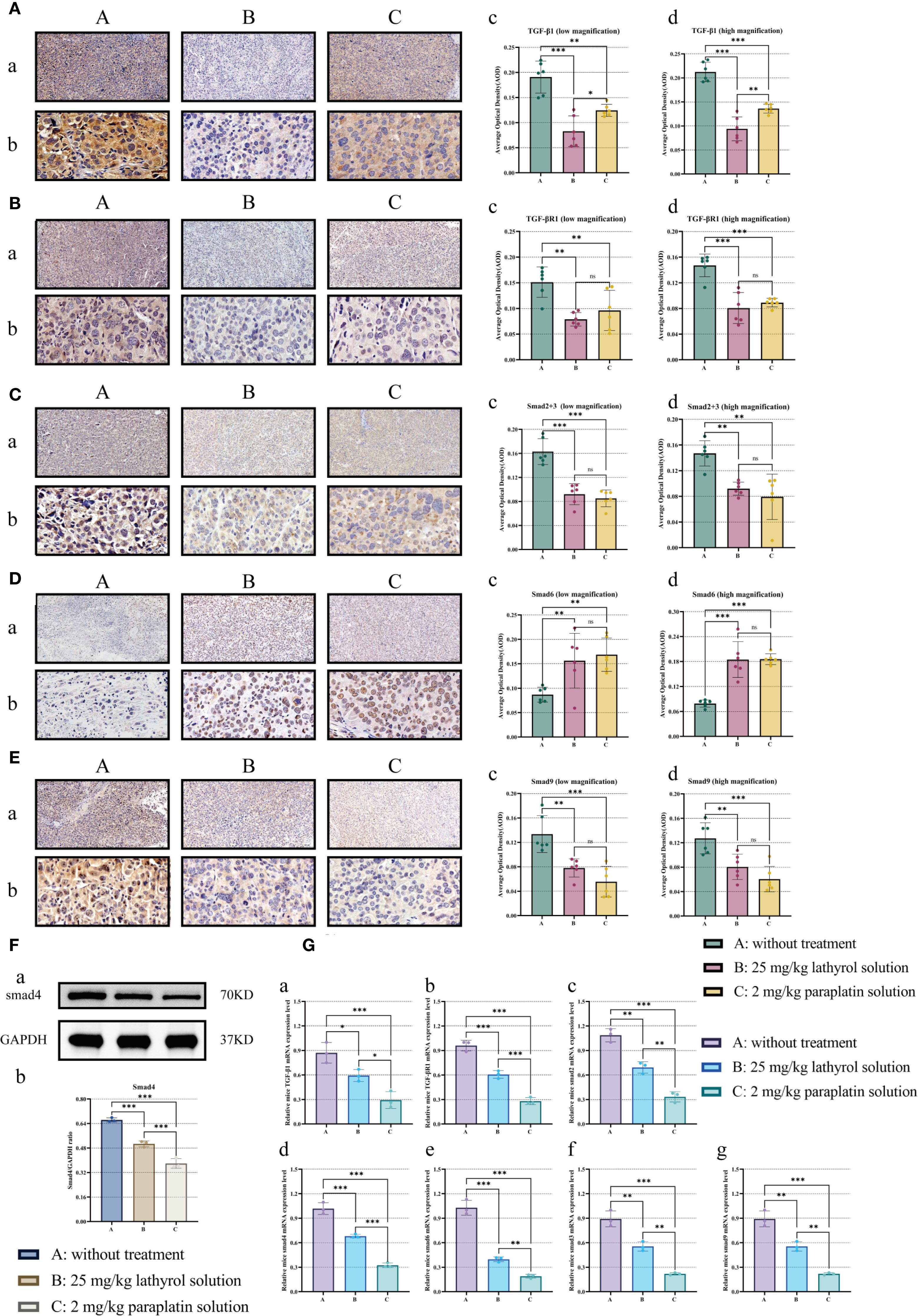 Histological images and graphs analyze different treatments: A (no treatment), B (25 mg/kg lathyrol solution), and C (2 mg/kg paraplatin solution). Panels A to E present tissue samples at low and high magnification. Graphs show Smad protein expression levels and their quantifications, highlighting treatment effects. Panel F shows a Western blot for Smad4 and GAPDH. Panel G includes bar charts summarizing the relative expressions. Data comparisons indicate statistical significance between treatments, marked by asterisks.
