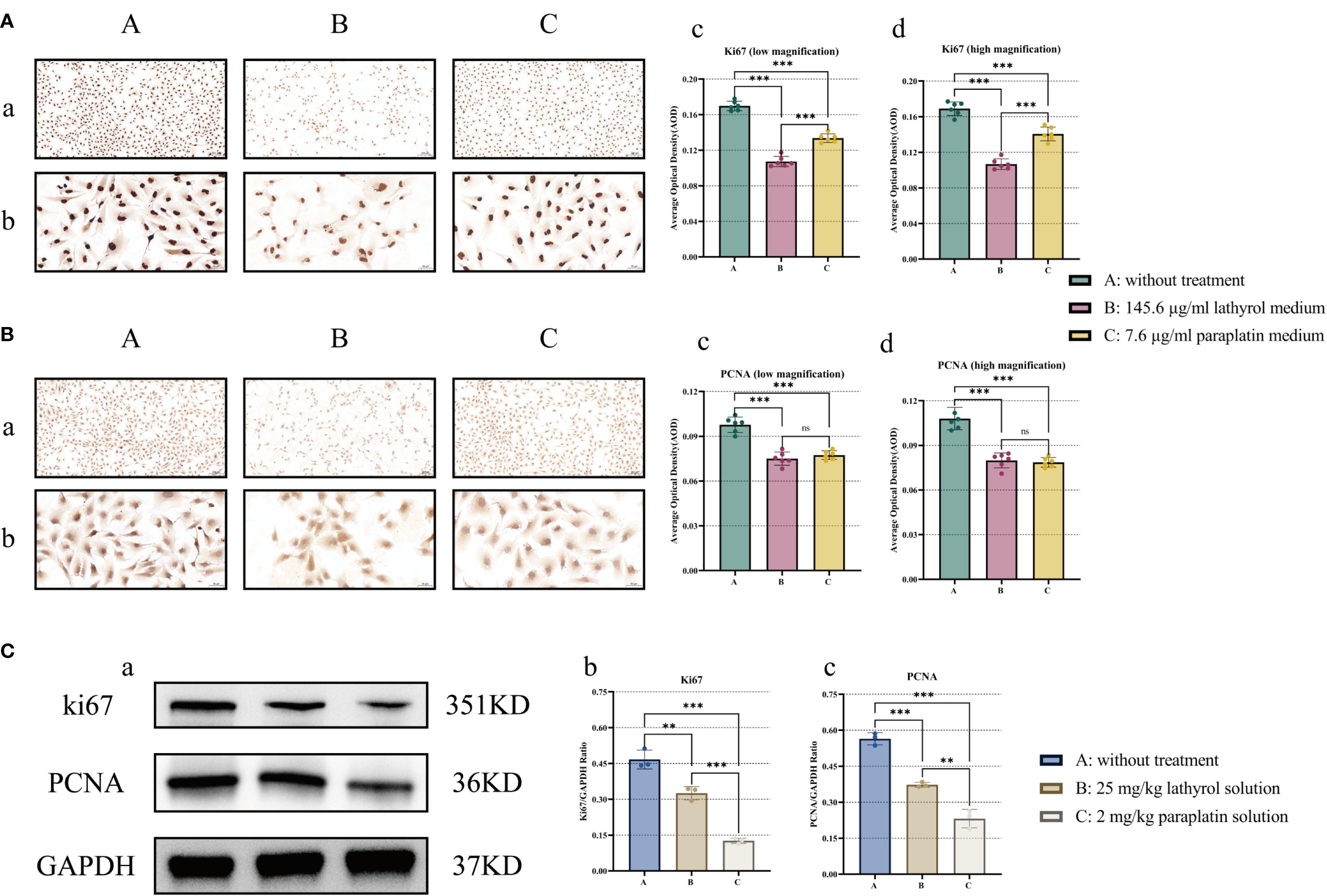 Panel A displays stained tissue samples under low and high magnification, with bar graphs (c and d) showing the average optical density for Ki67. Panel B also shows stained tissue samples under different conditions with bar graphs (c and d) indicating the average optical density for PCNA. Panel C features Western blot images analyzing the expression of Ki67, PCNA, and GAPDH, accompanied by bar graphs (b and c) displaying relative expression ratios. Experimental groups include untreated, Lathyrol-treated, and Paraplatin-treated conditions. Statistical significance is indicated with asterisks.