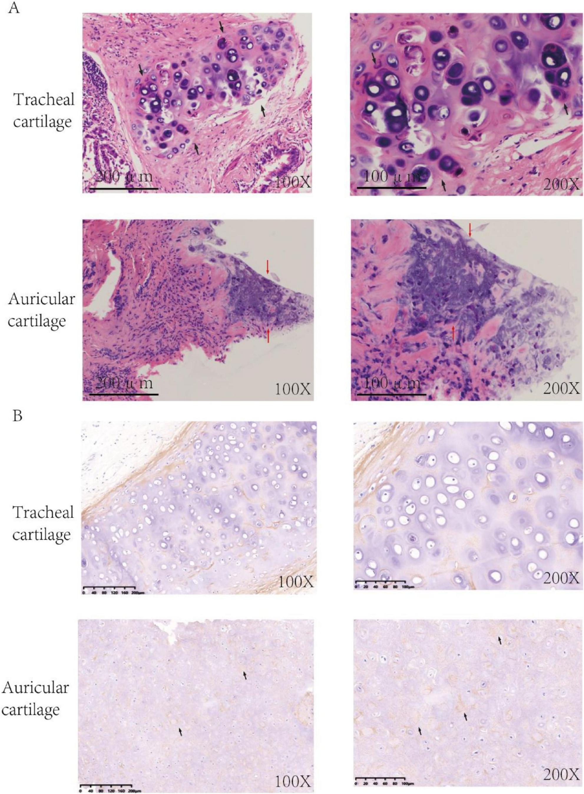 Histological images show tracheal and auricular cartilage stained with different magnifications. Panel A shows tracheal cartilage at 100X and 200X with prominent lacunae. Auricular cartilage is also shown at 100X and 200X. Panel B shows similar tissues, highlighting cellular structures with increased magnification, illustrating cellular and matrix differences between cartilages.