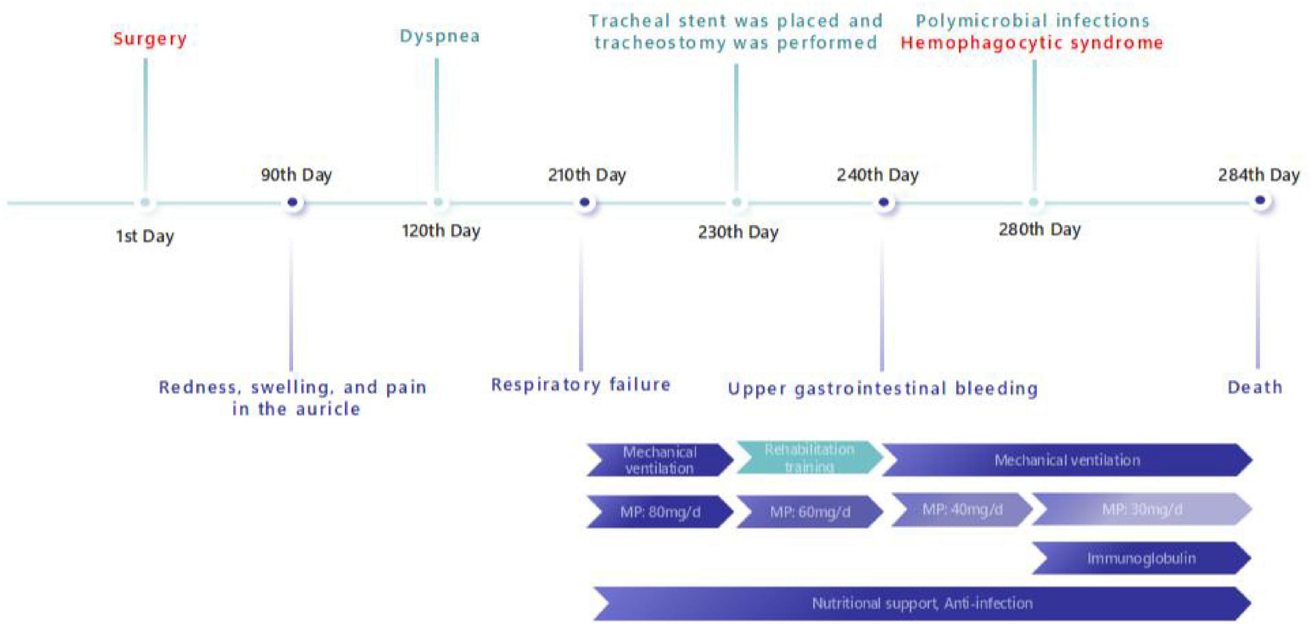 Timeline depicting a medical case progression. Key events: Surgery on day 1; dyspnea on day 90; tracheal stent and tracheostomy on day 210; polymicrobial infections and hemophagocytic syndrome on day 240; death on day 284. Symptoms include redness and swelling in the auricle, respiratory failure, and upper gastrointestinal bleeding. Treatments include mechanical ventilation, rehabilitation training, varying doses of medication (MP), immunoglobulin, nutritional support, and anti-infection measures.