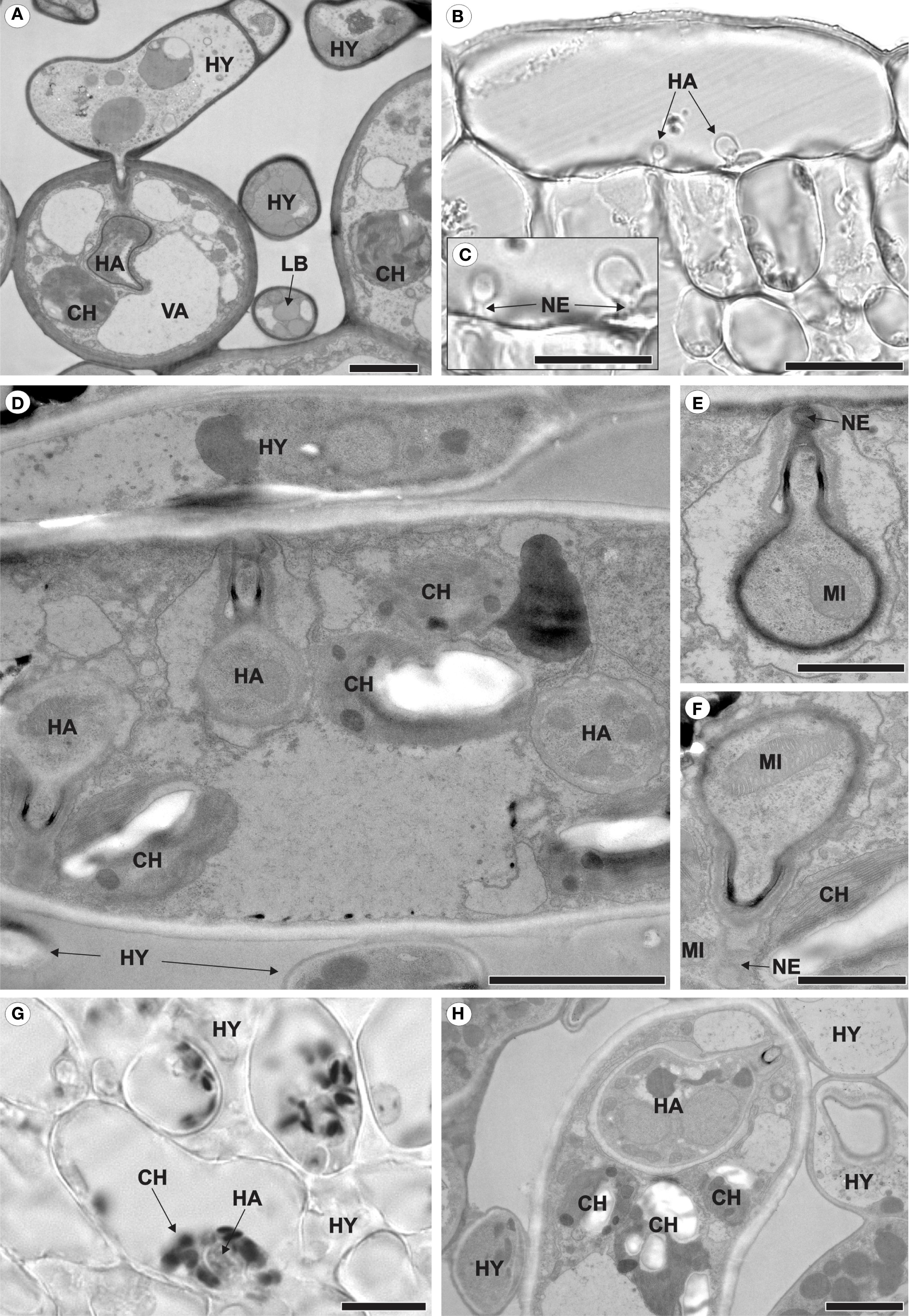 Alt-Text – Microscopic images showing plant cellular structures labeled with abbreviations such as CH (chloroplasts), VA (vacuole), NE (haustorial neck), and fungalstructures HY (hyphae), HA (haustoria), LB (lipid body), and MI (mitochondria). Each panel highlights different aspects and arrangements of these structures. Bars indicate scale for each image.